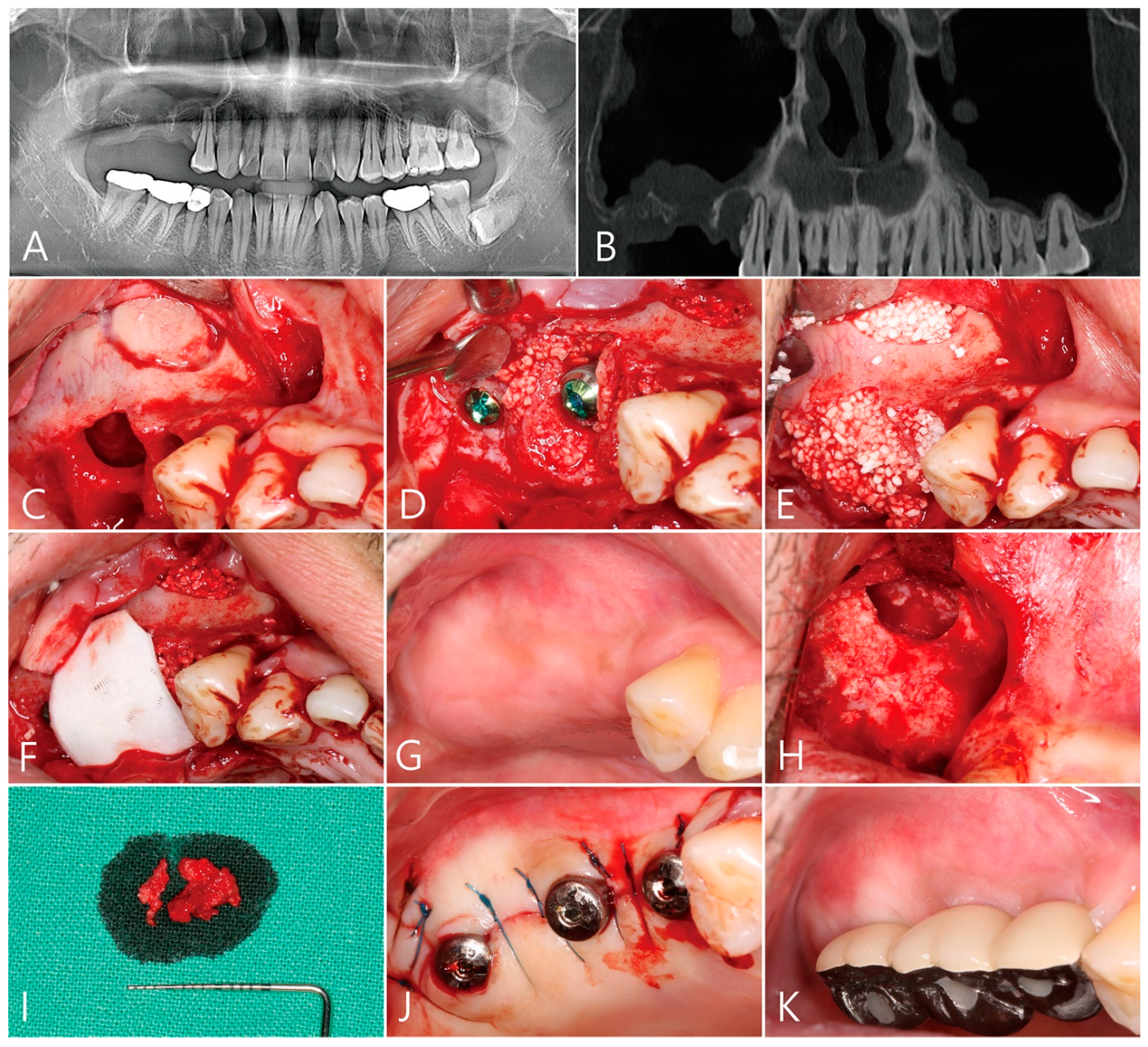 Medicina 58 01300 g001