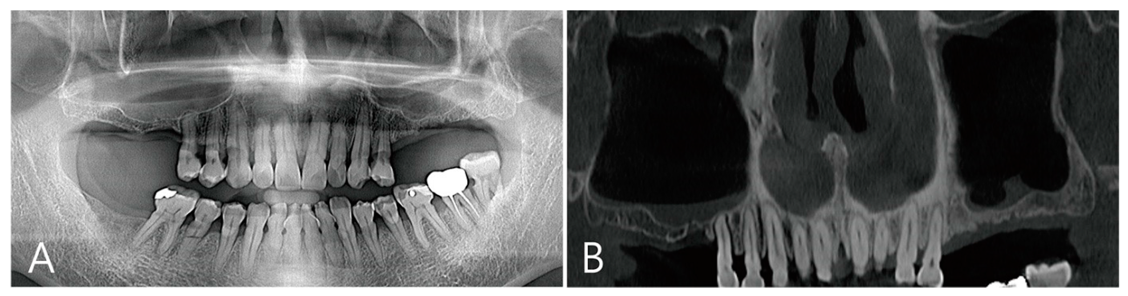 Medicina 58 01300 g004
