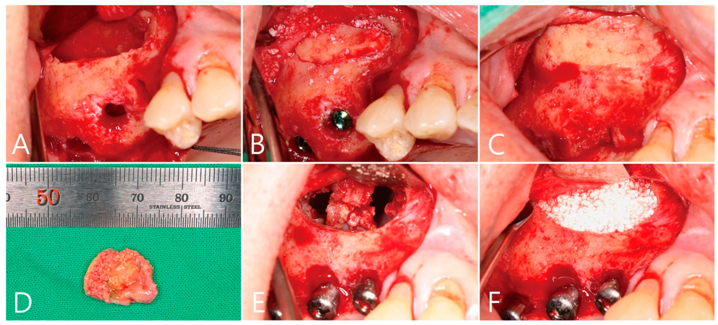 Medicina 58 01300 g005
