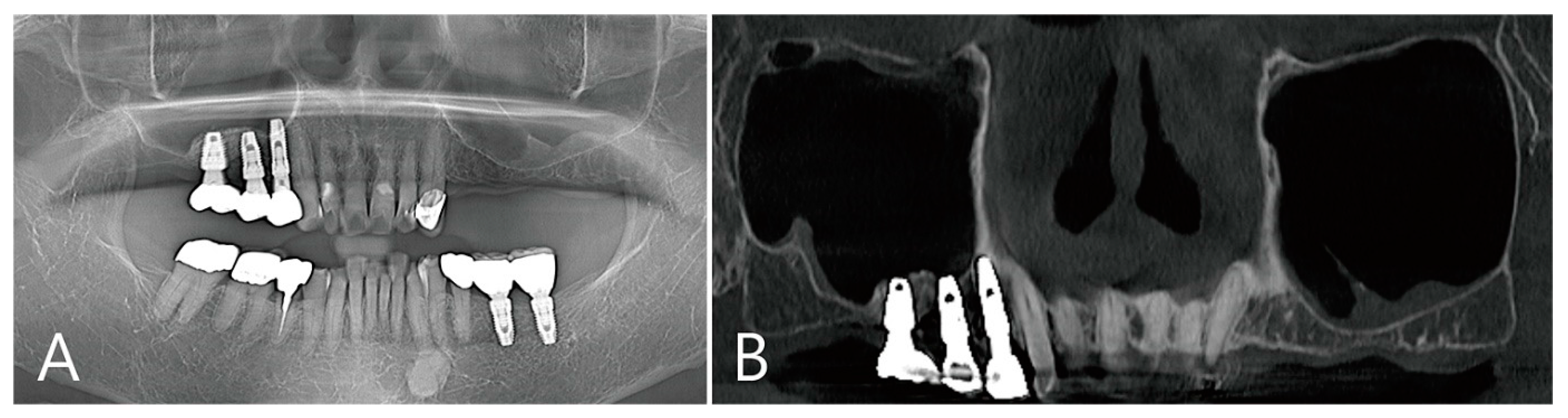 Medicina 58 01300 g010