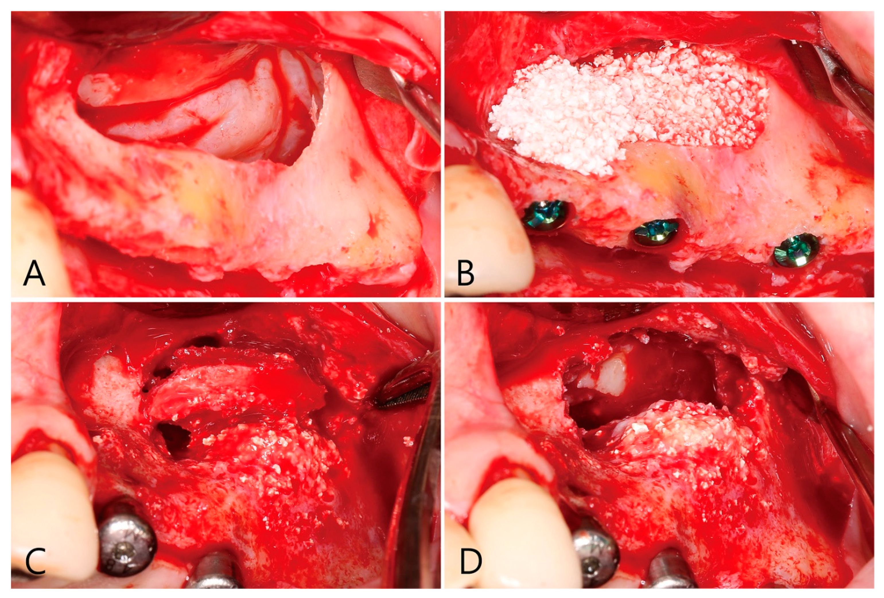 Medicina 58 01300 g011