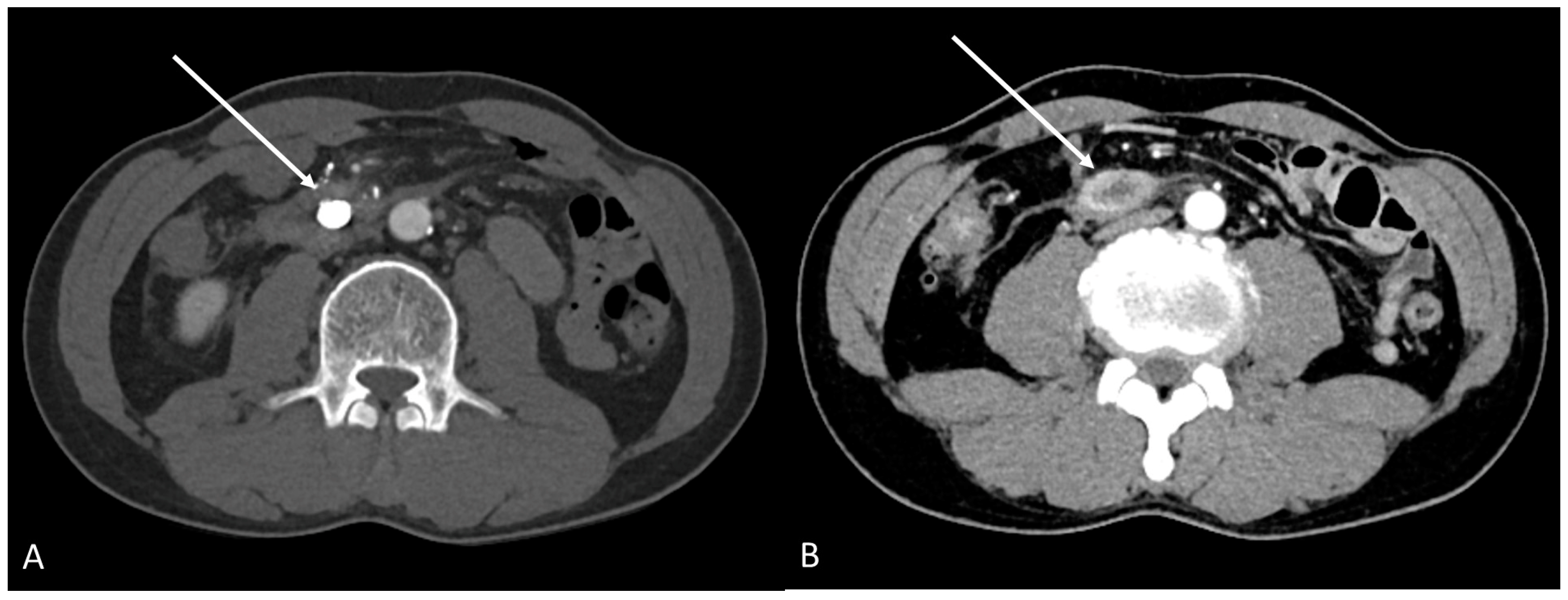 Medicina 58 01320 g003