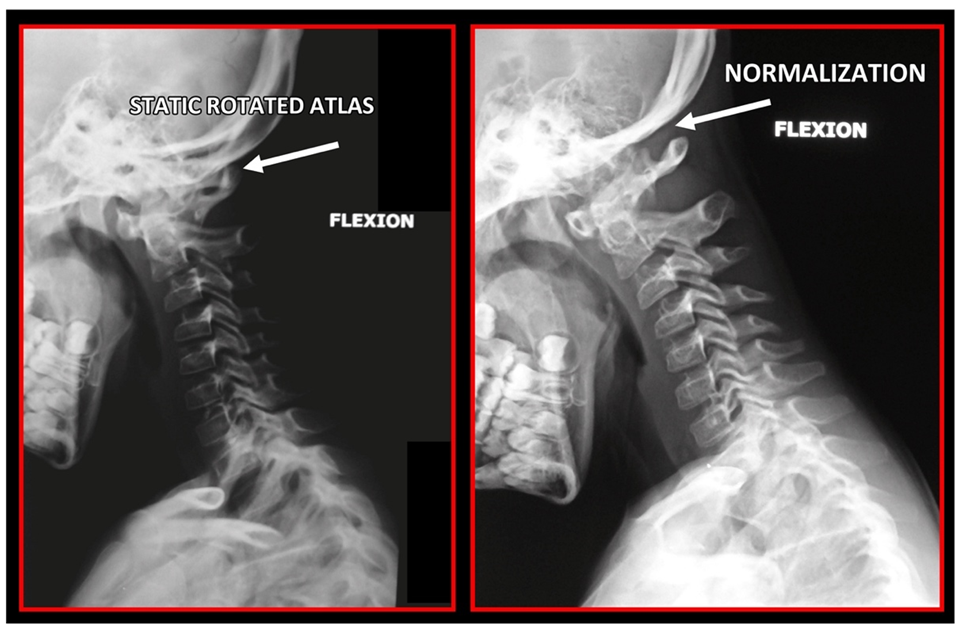 Medicina 58 01324 g011