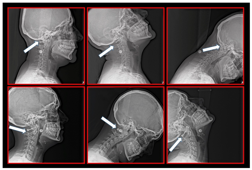 Medicina 58 01324 g014
