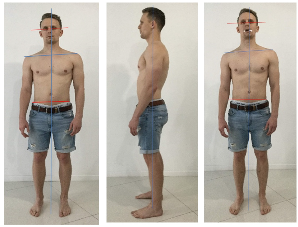 Medicina 58 01324 g029