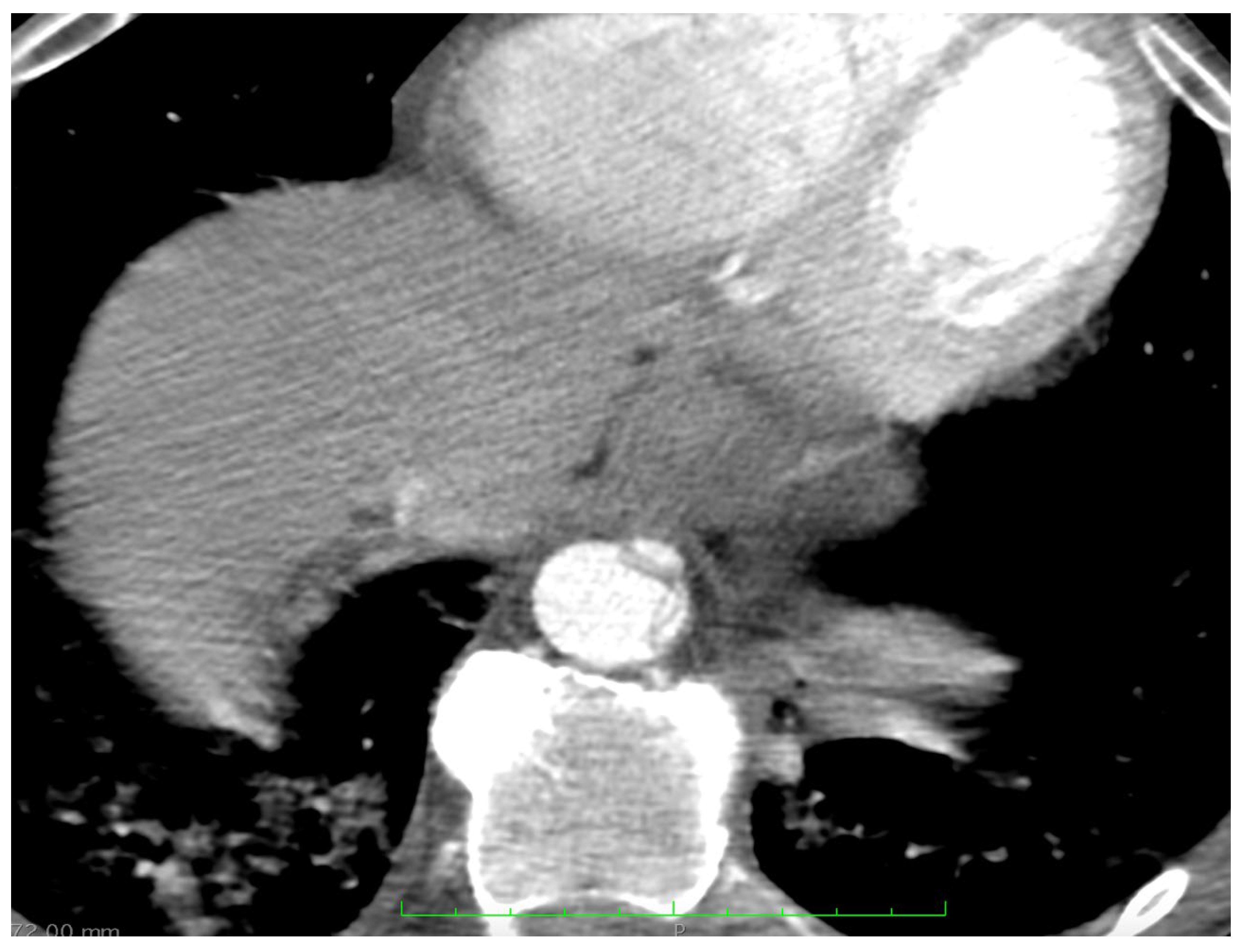 Medicina 58 01357 g005