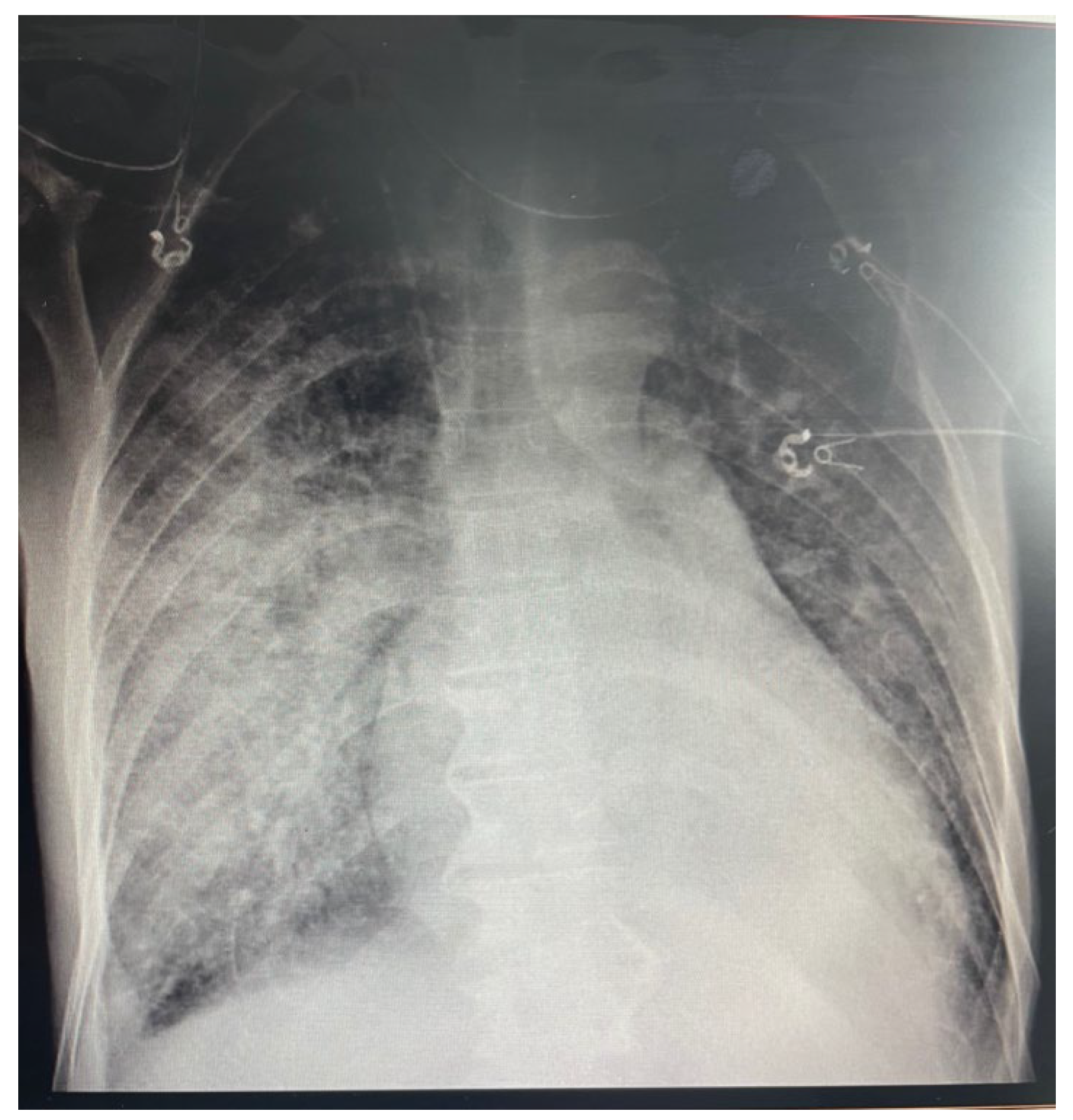 Medicina 58 01357 g007