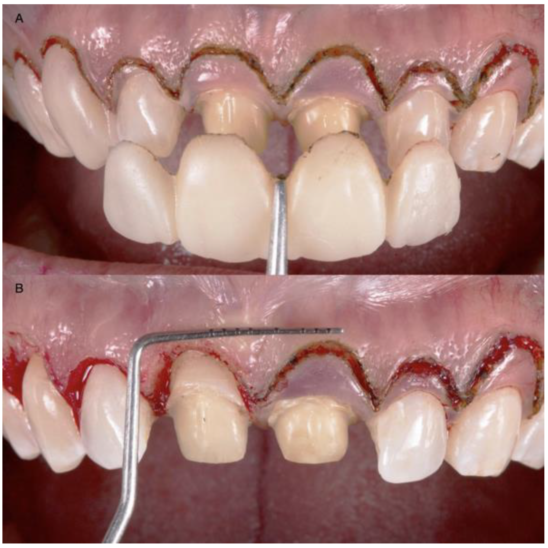 Medicina 58 01360 g004