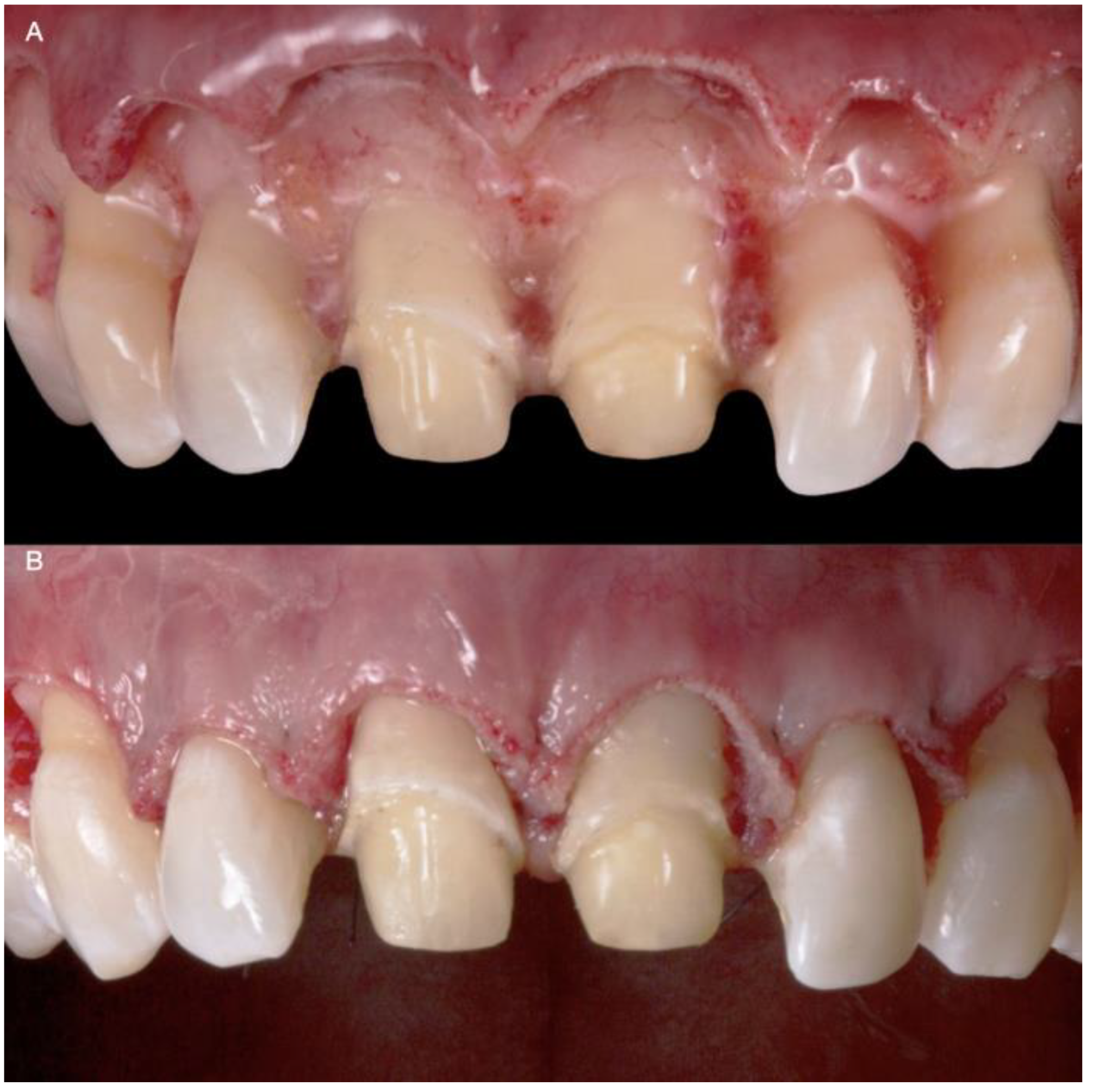 Medicina 58 01360 g006