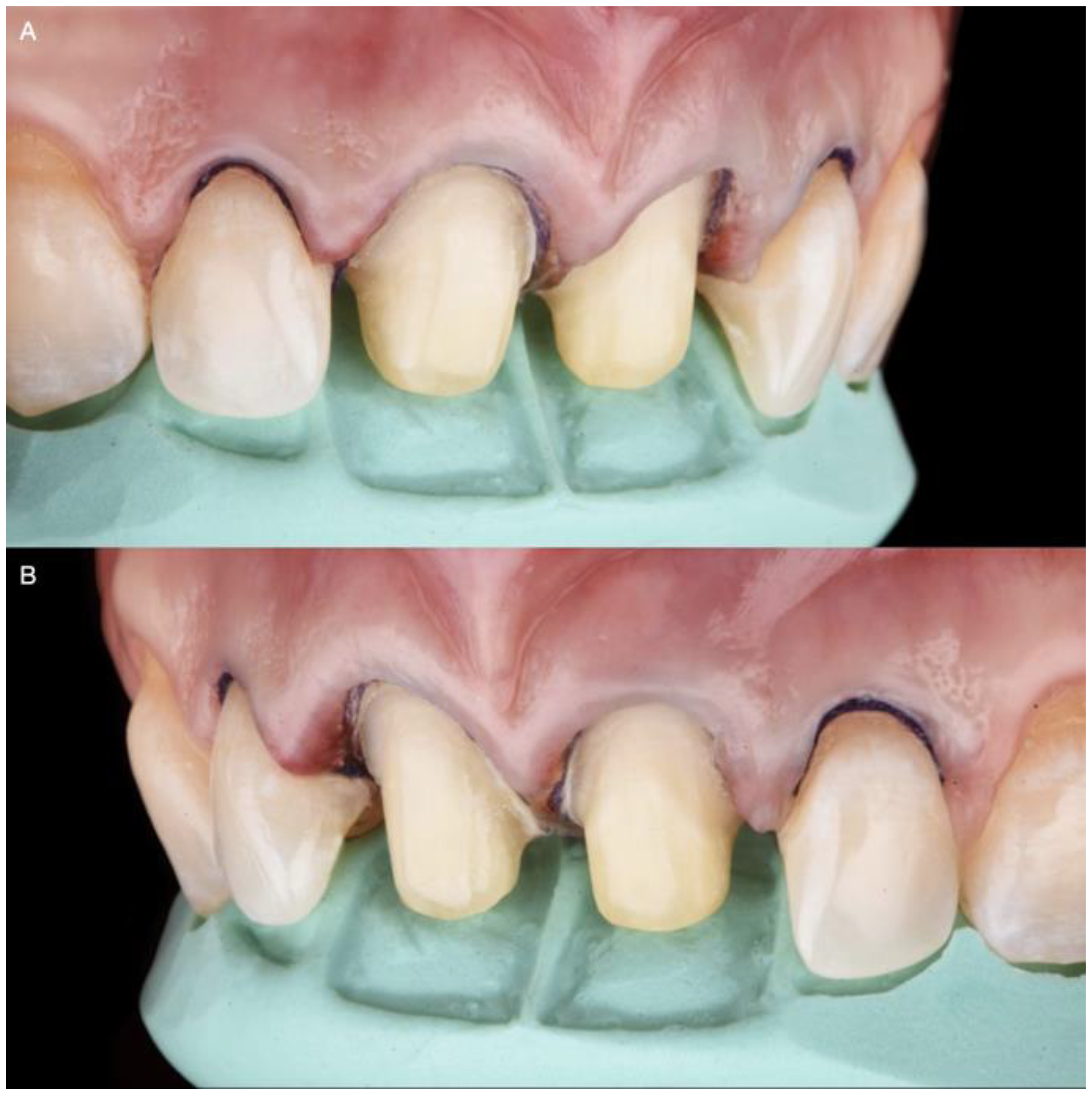 Medicina 58 01360 g007