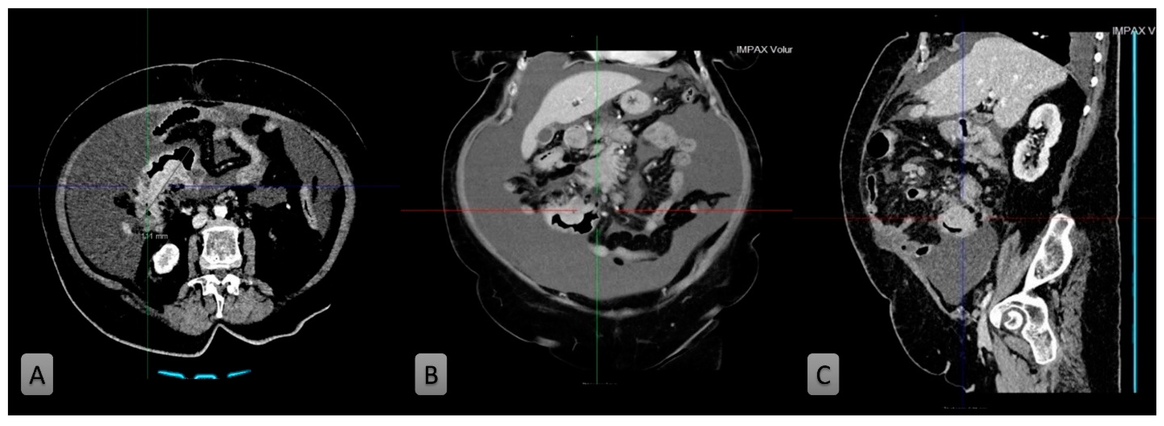 Medicina 58 01381 g001