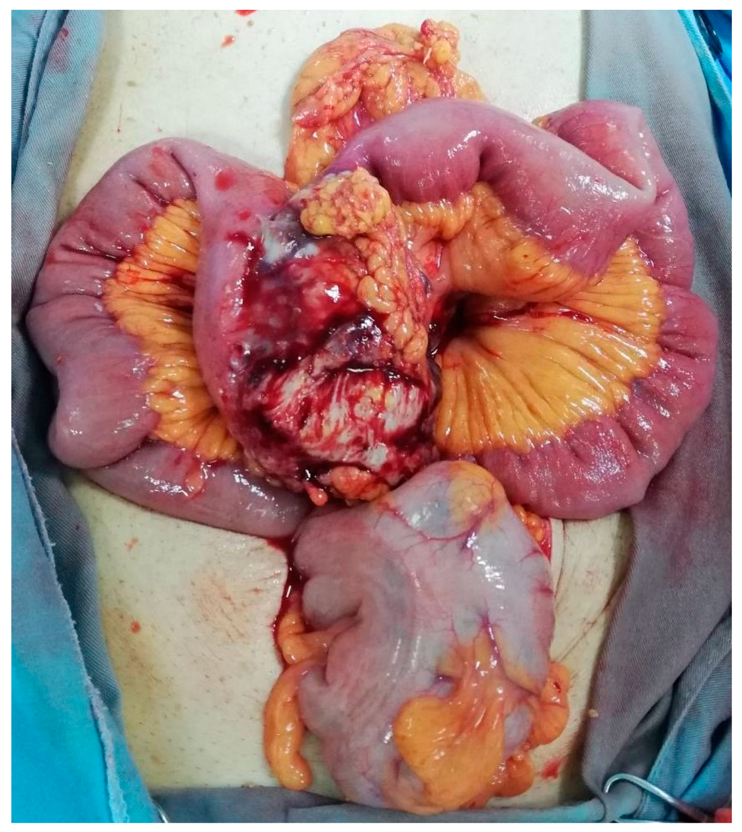 Medicina 58 01381 g002