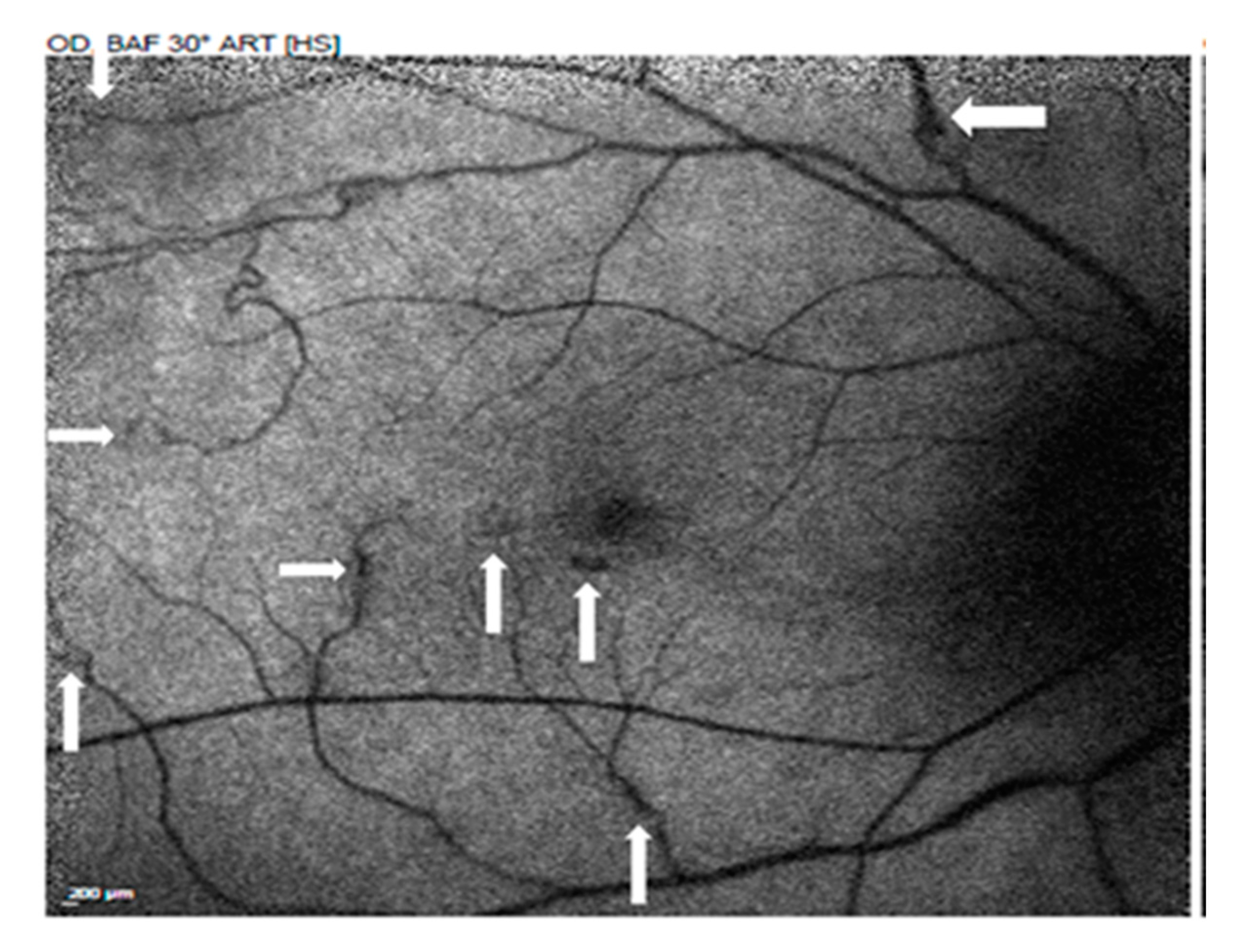 Medicina 58 01467 g003