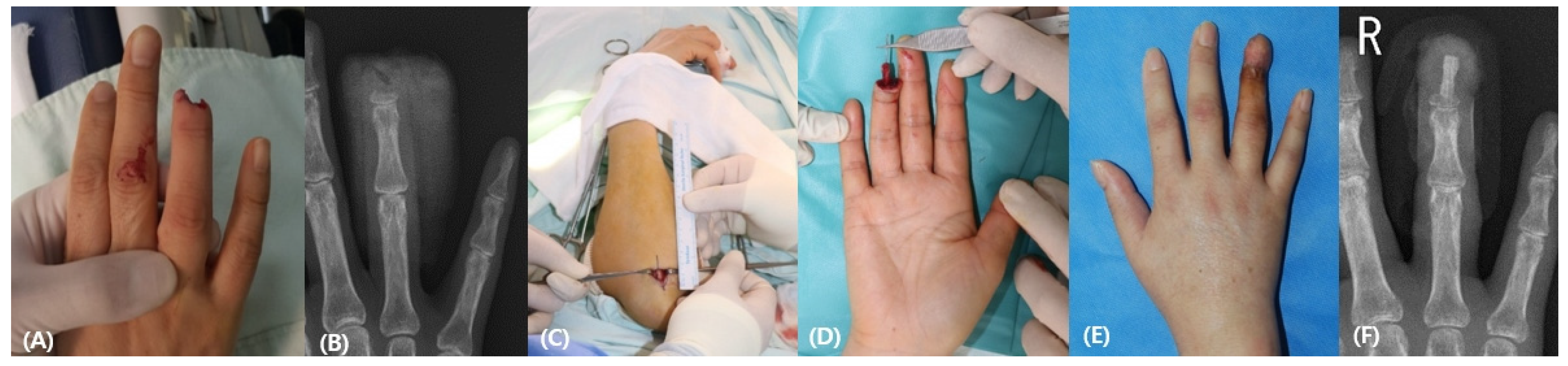 Medicina 58 01483 g004