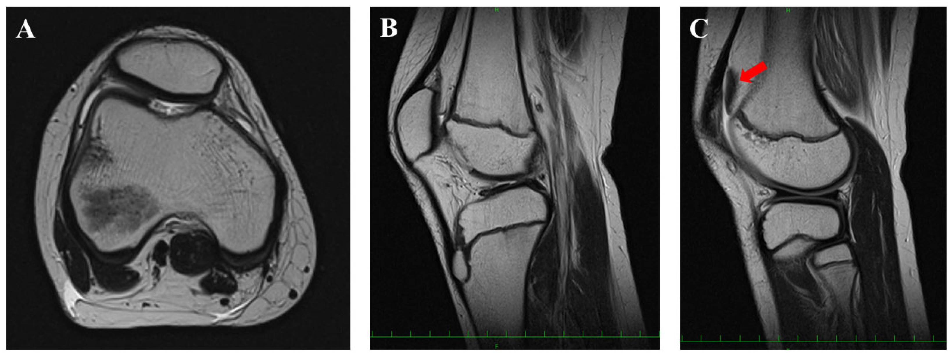 Medicina 58 01528 g002