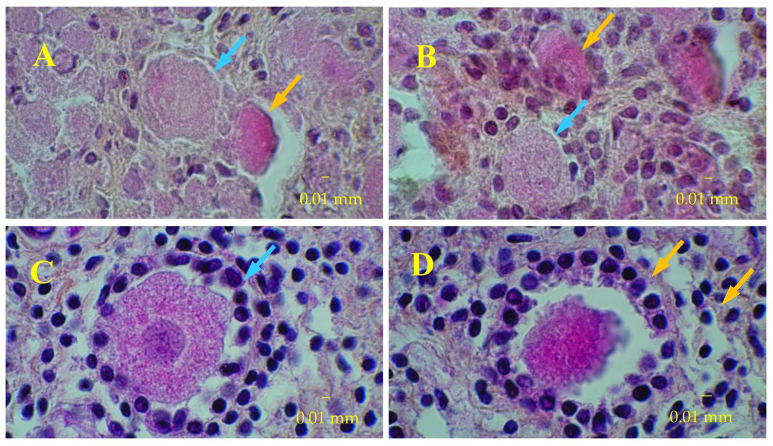 Medicina 58 01565 g005