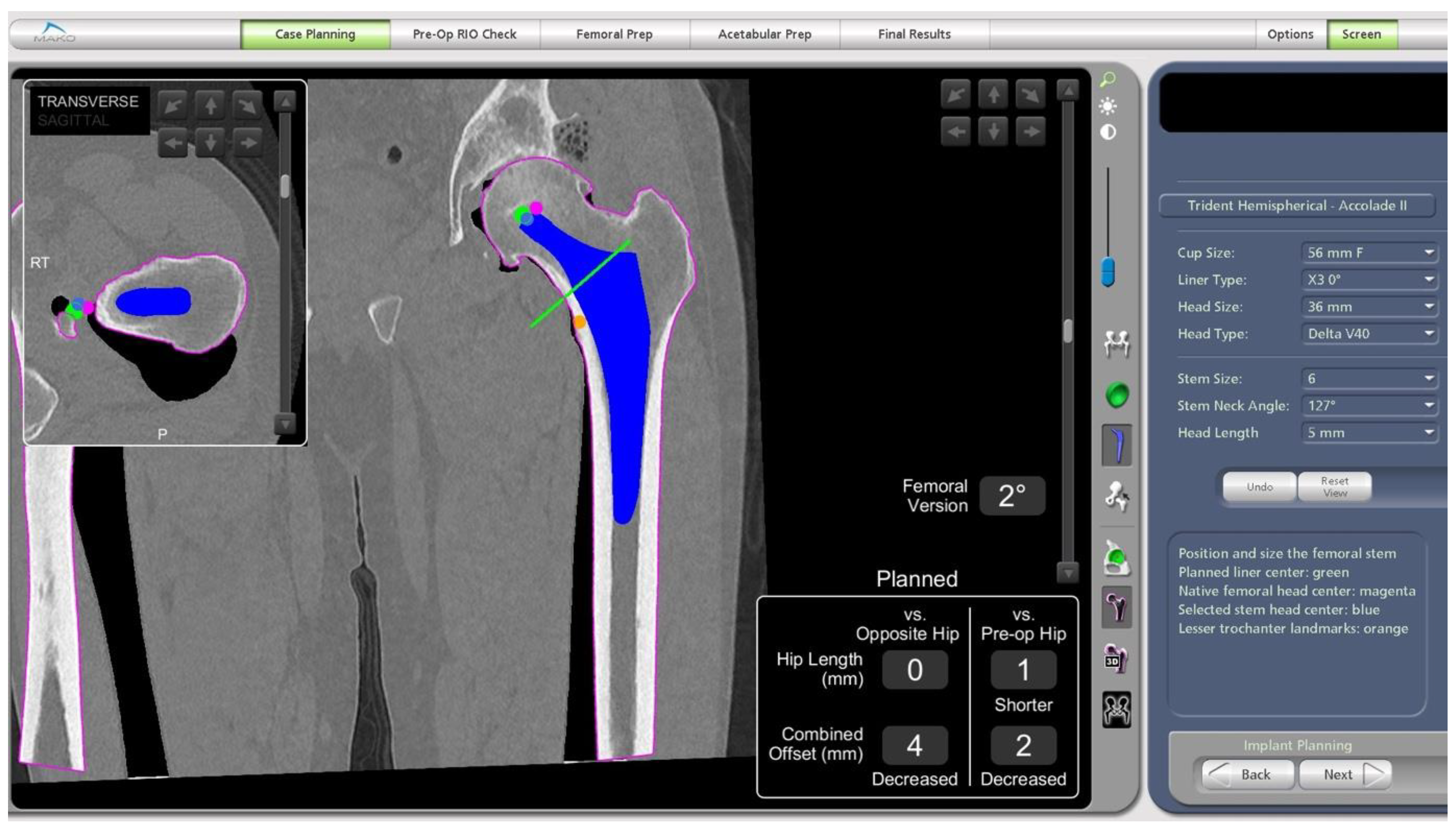 Medicina 58 01616 g004