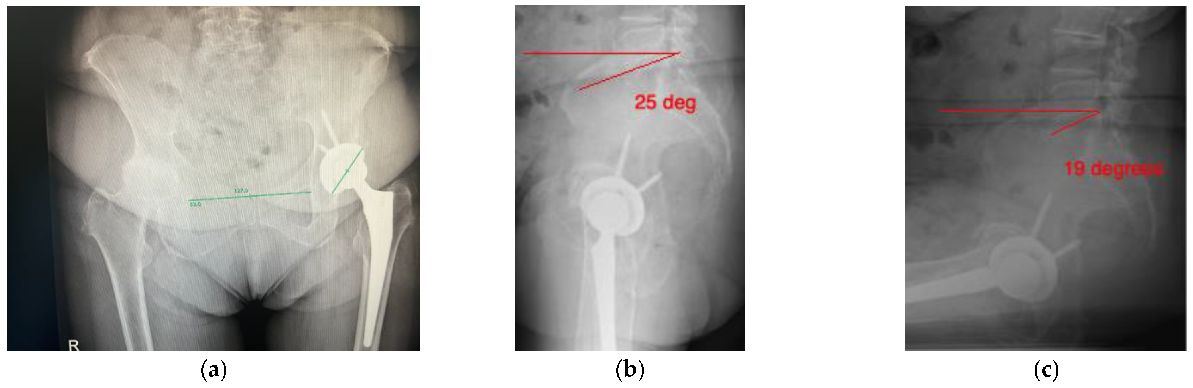 Medicina 58 01616 g006