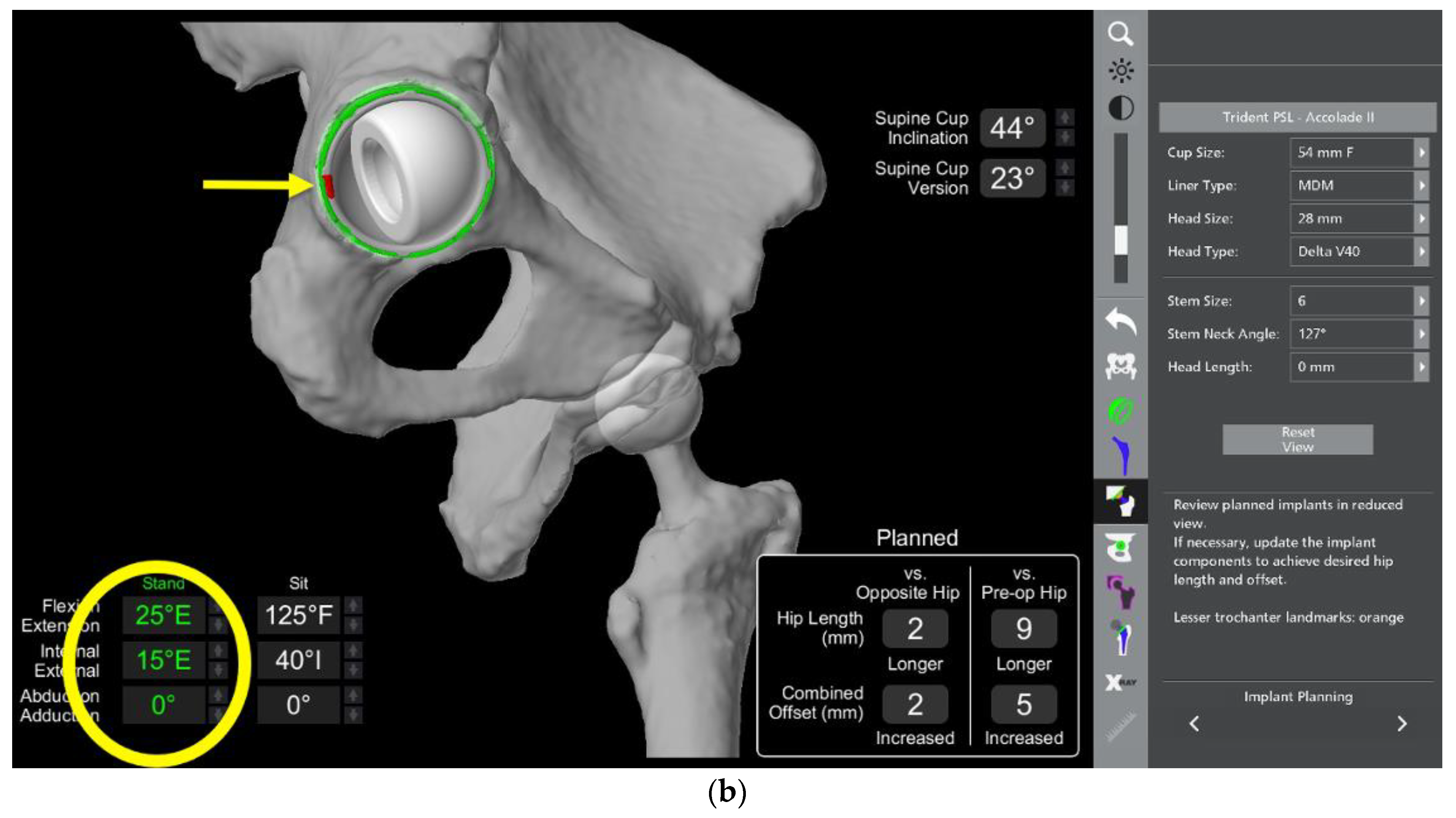 Medicina 58 01616 g011b