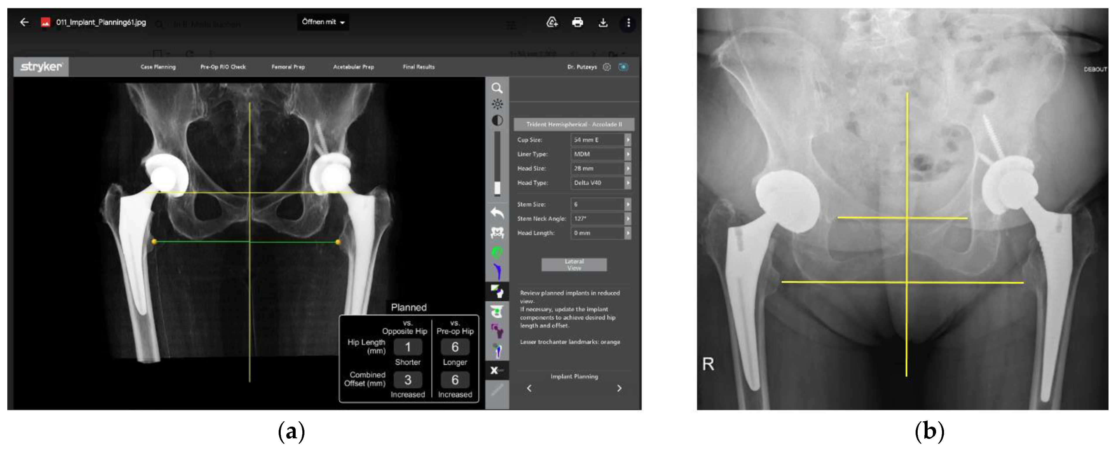 Medicina 58 01616 g012