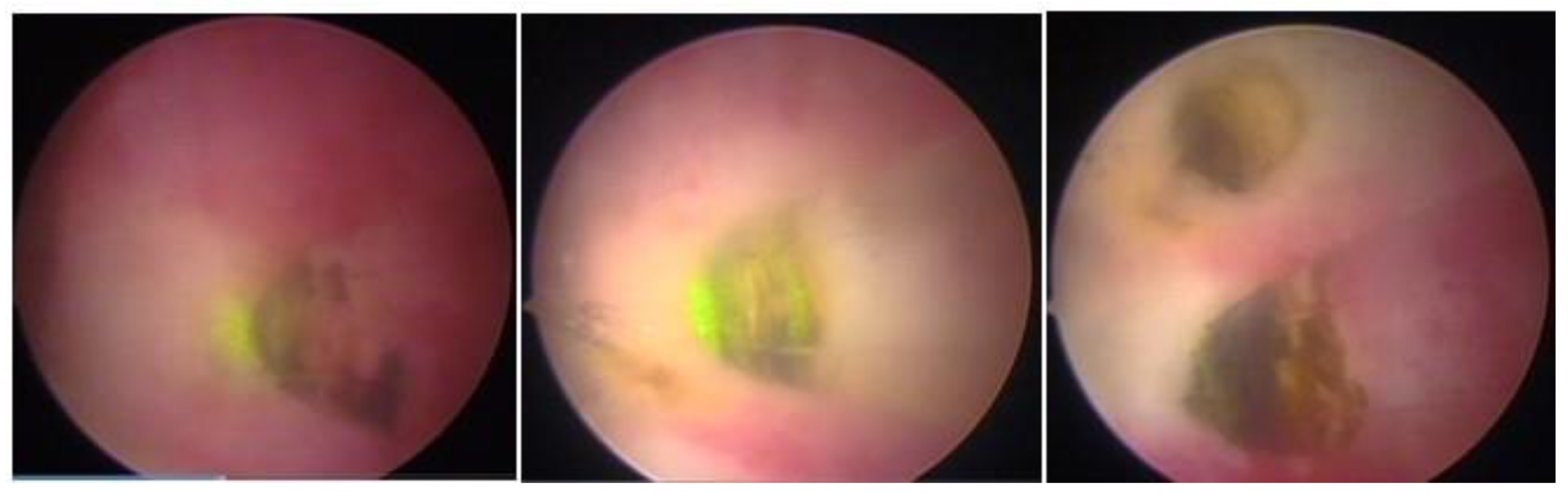 Medicina 58 01627 g012