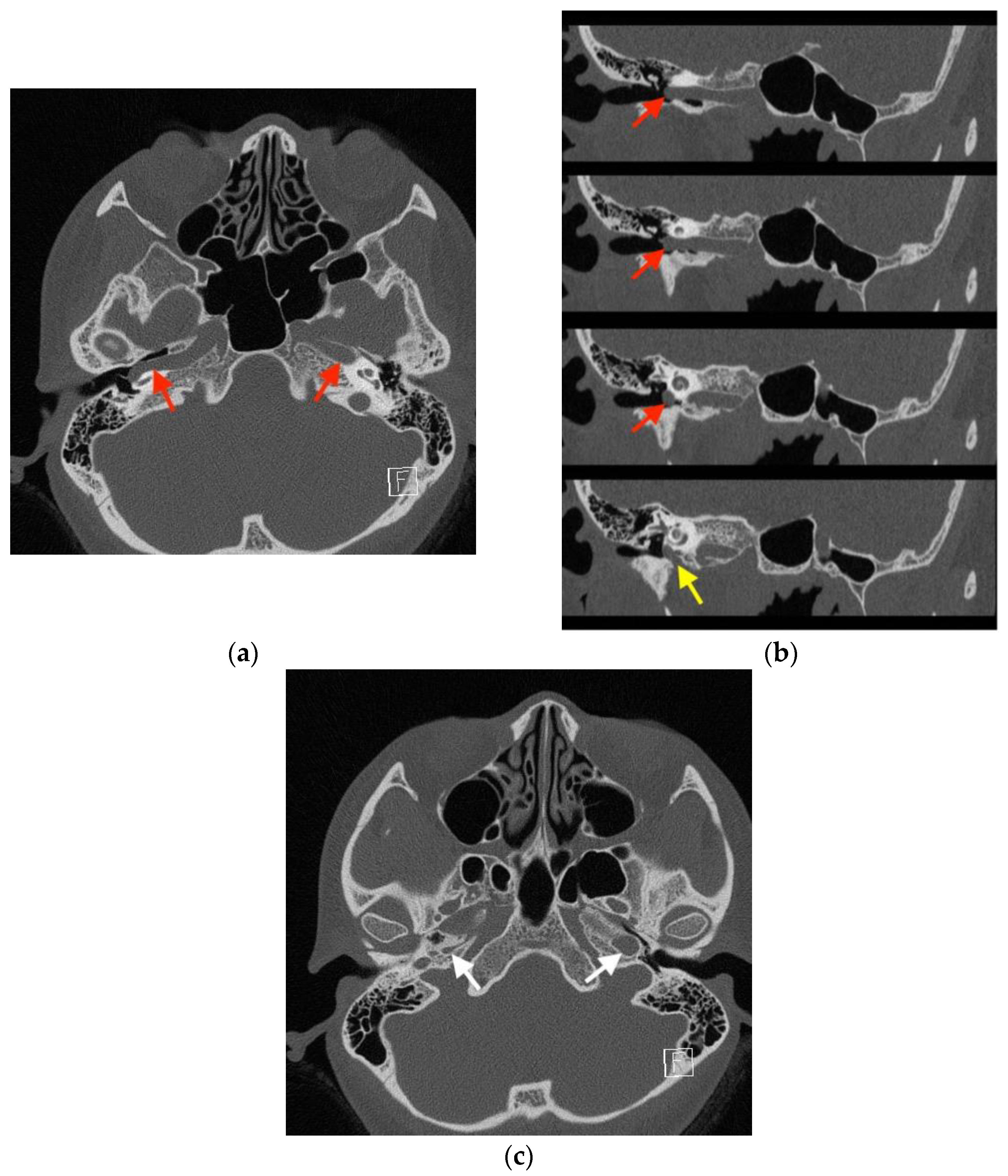 Medicina 58 01672 g003 Medicina 58 01672 g003