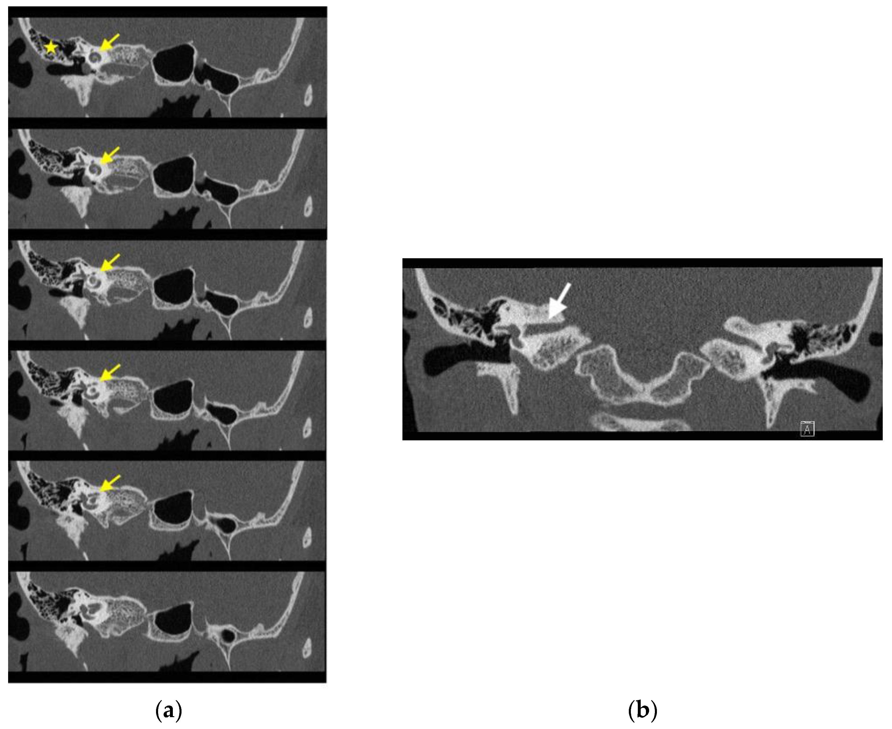 Medicina 58 01672 g004 Medicina 58 01672 g004