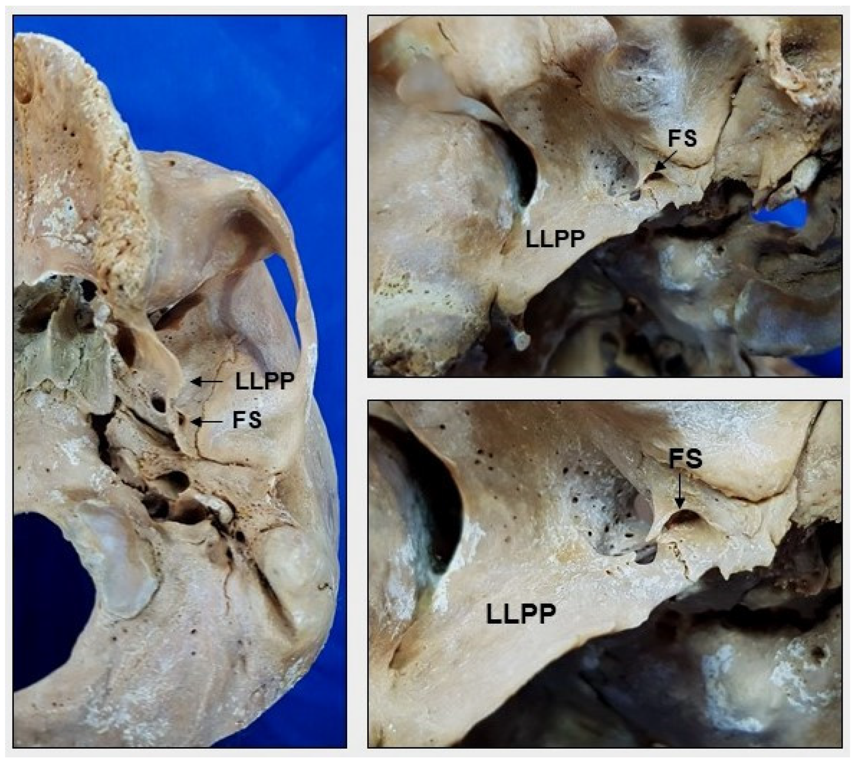 Medicina 58 01740 g005
