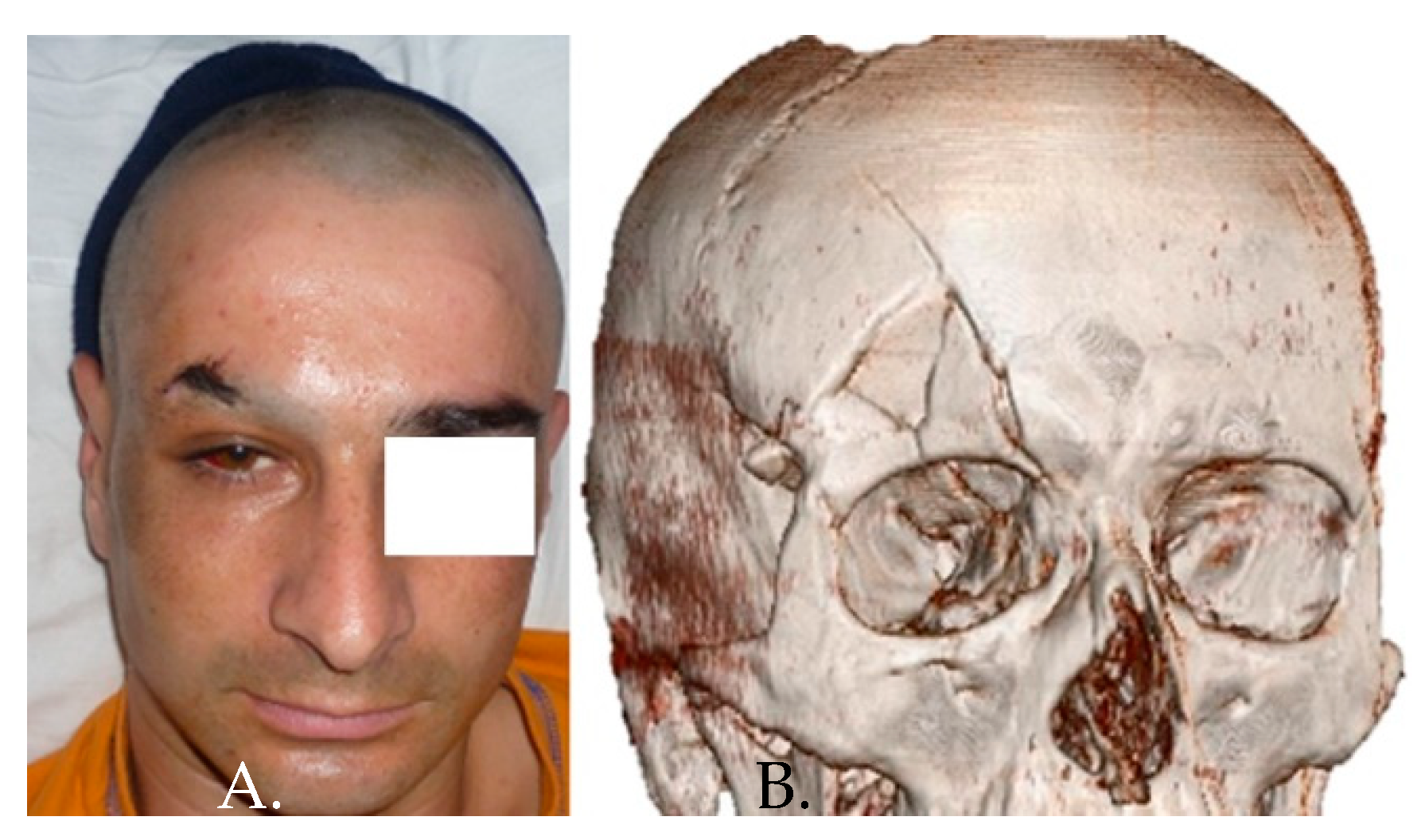 Medicina 58 01756 g003