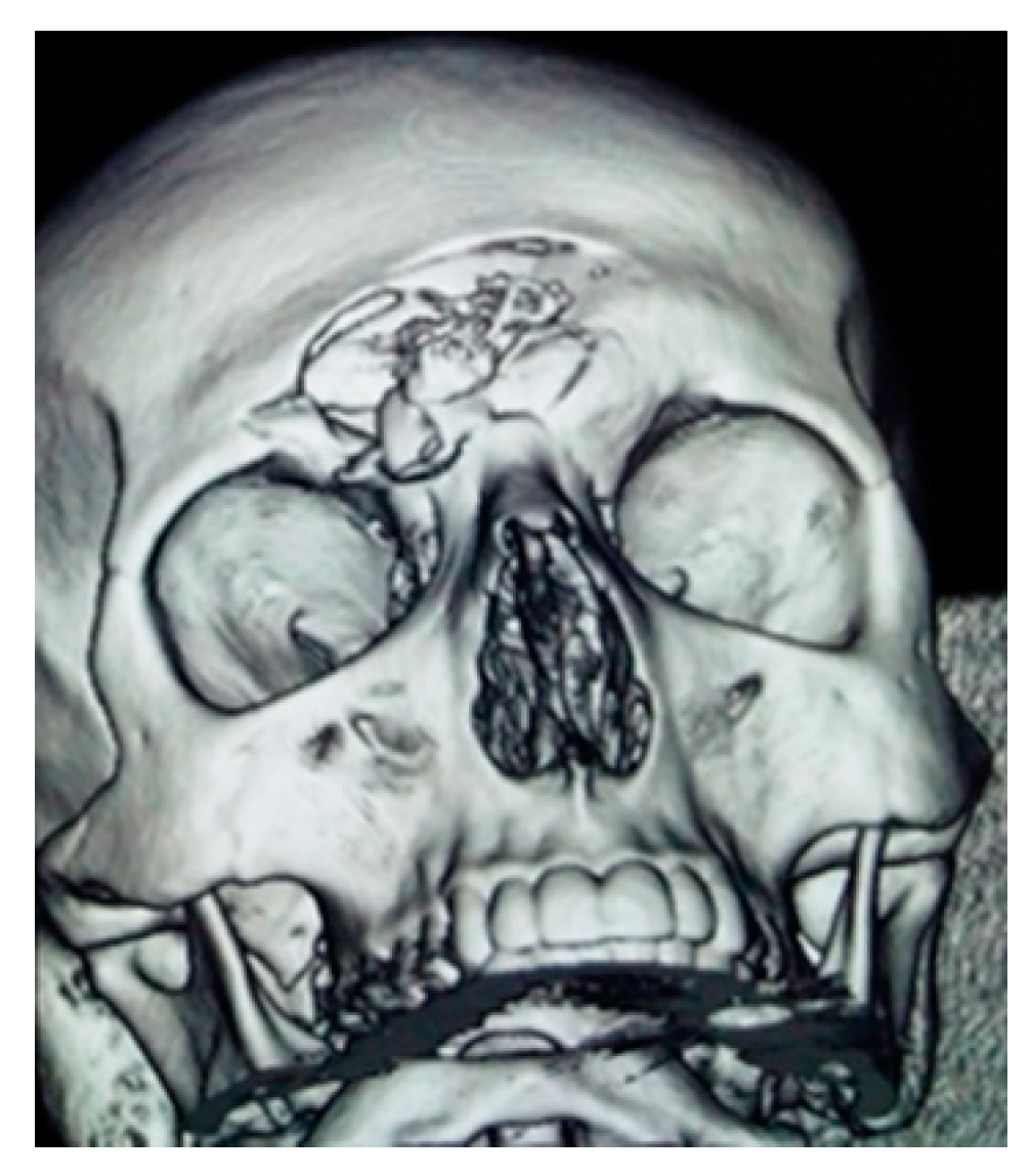 Medicina 58 01756 g005