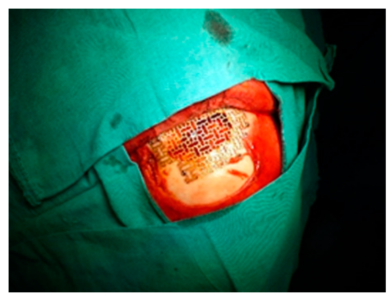 Medicina 58 01756 g006