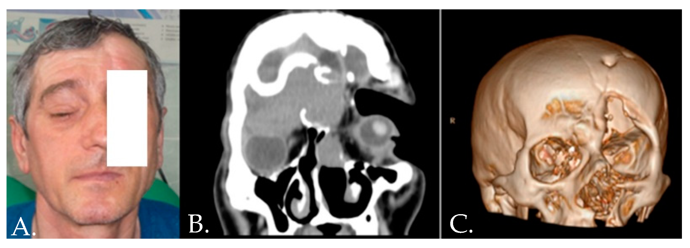 Medicina 58 01756 g007