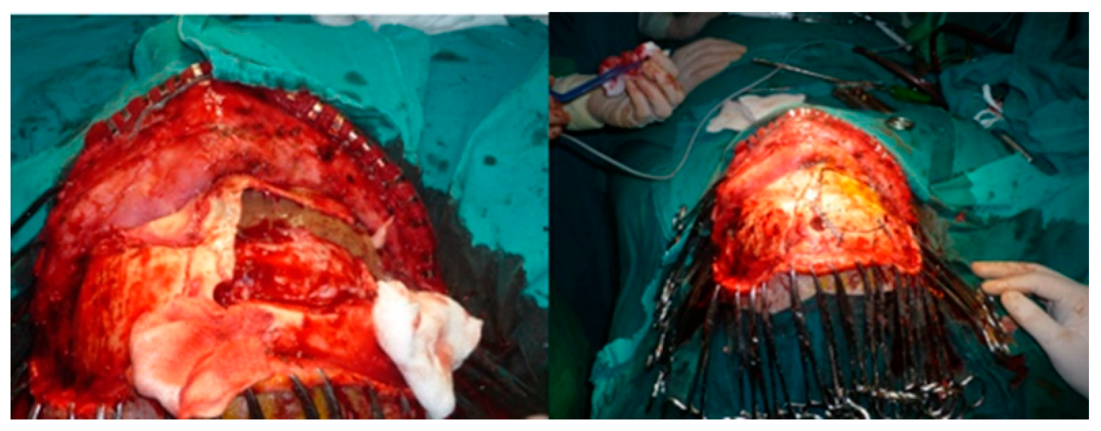 Medicina 58 01756 g008