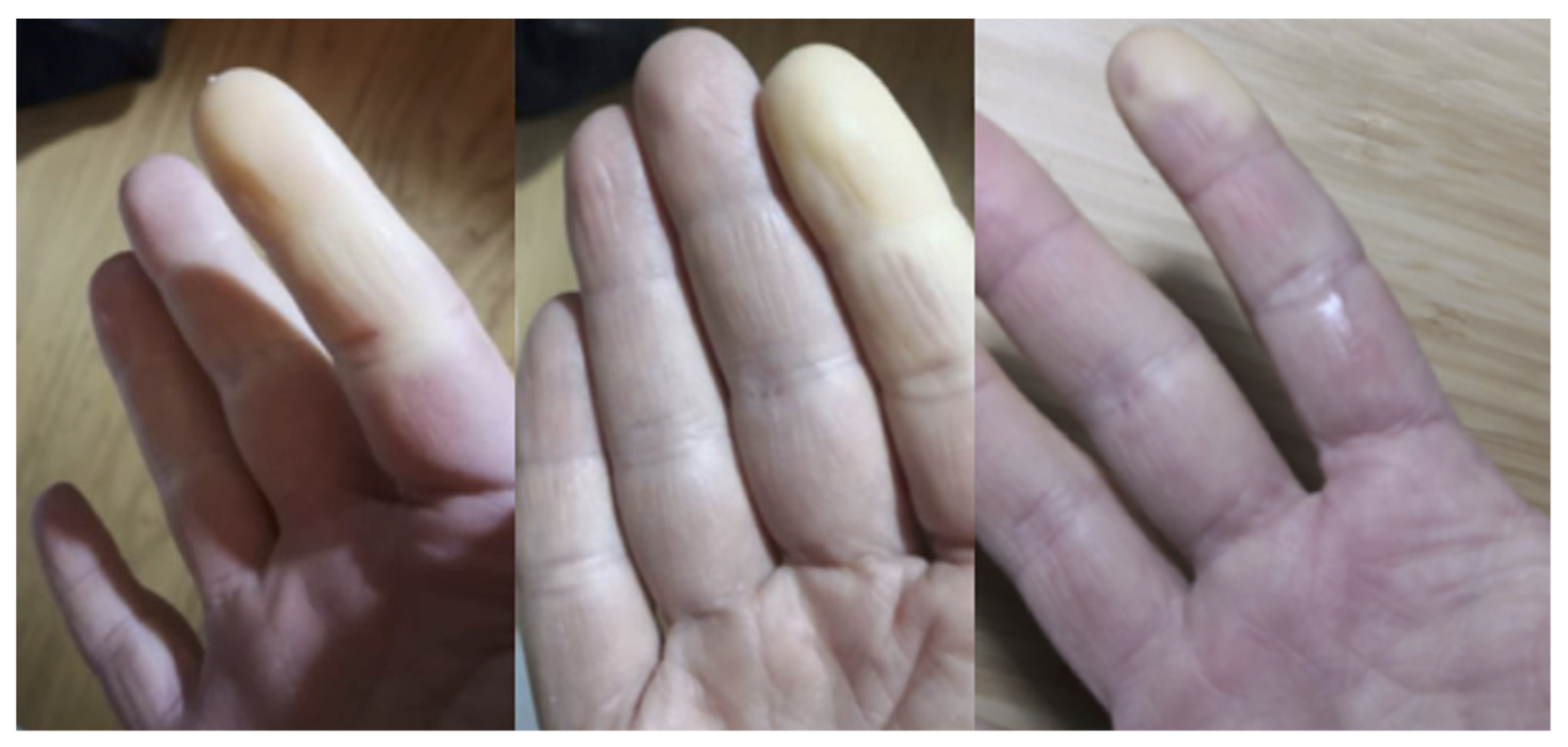 Medicina 58 01757 g004