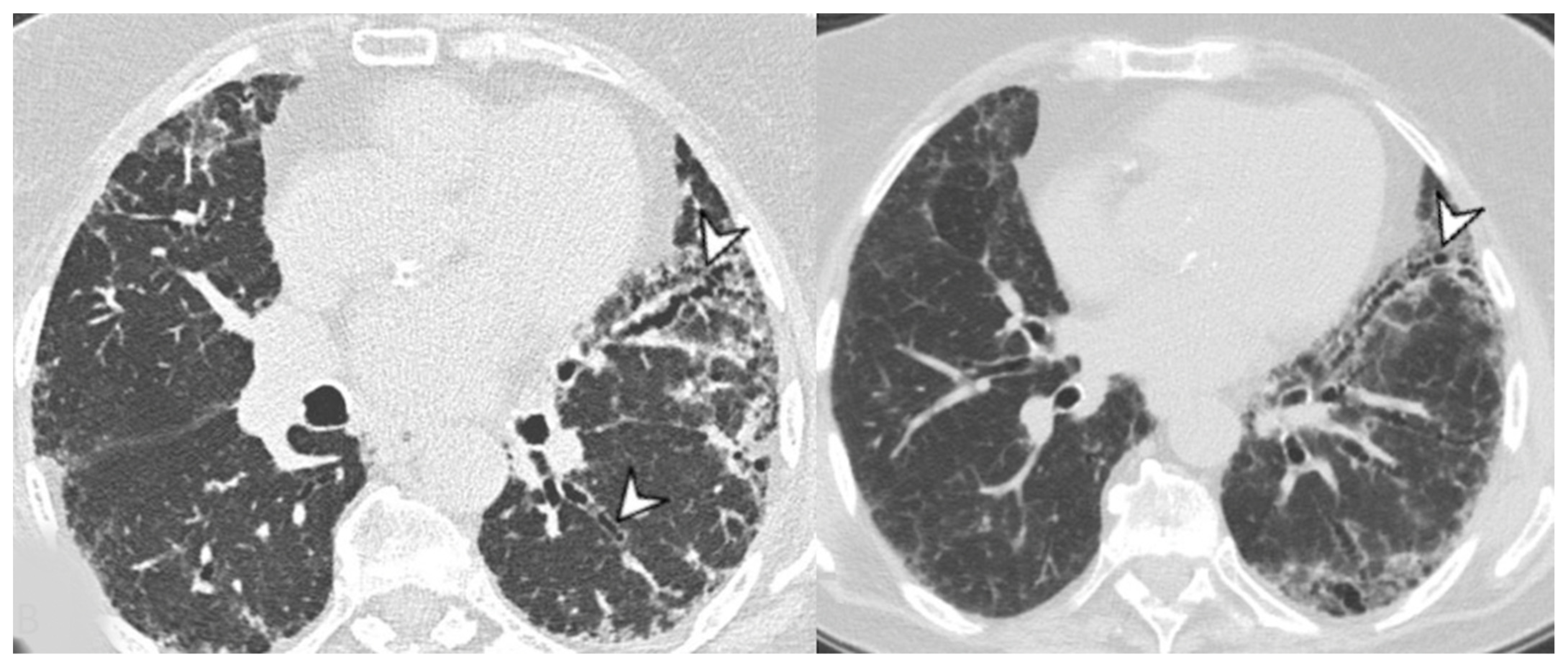 Medicina 58 01757 g007