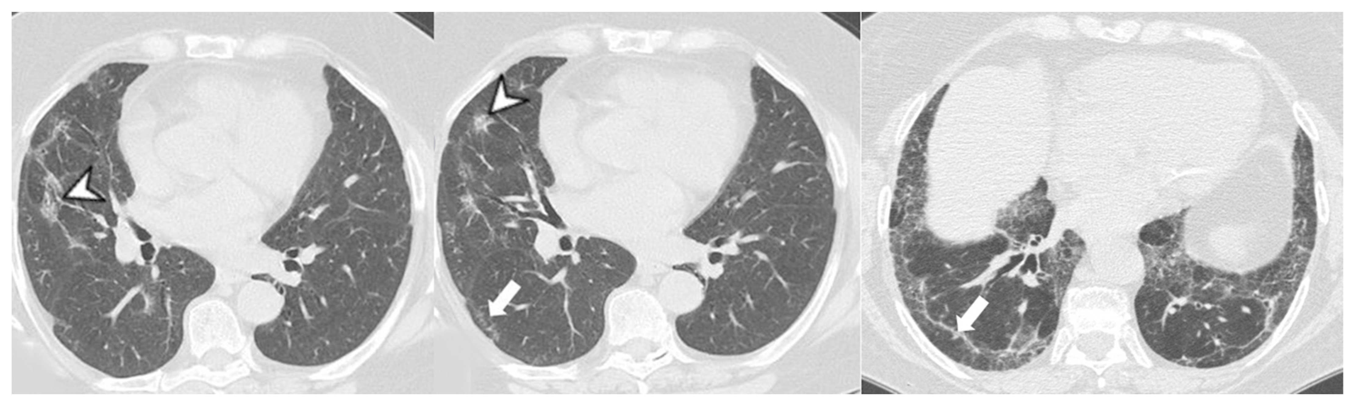 Medicina 58 01757 g008