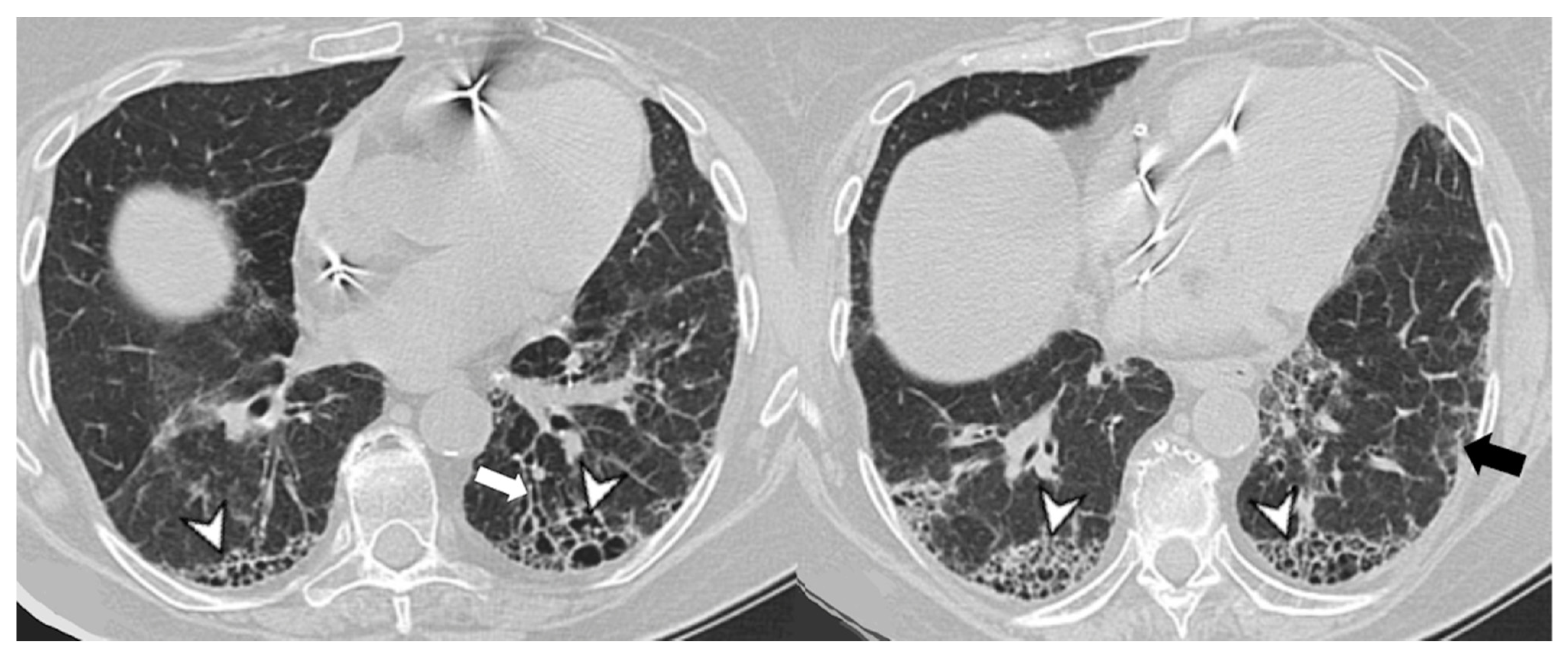 Medicina 58 01757 g011
