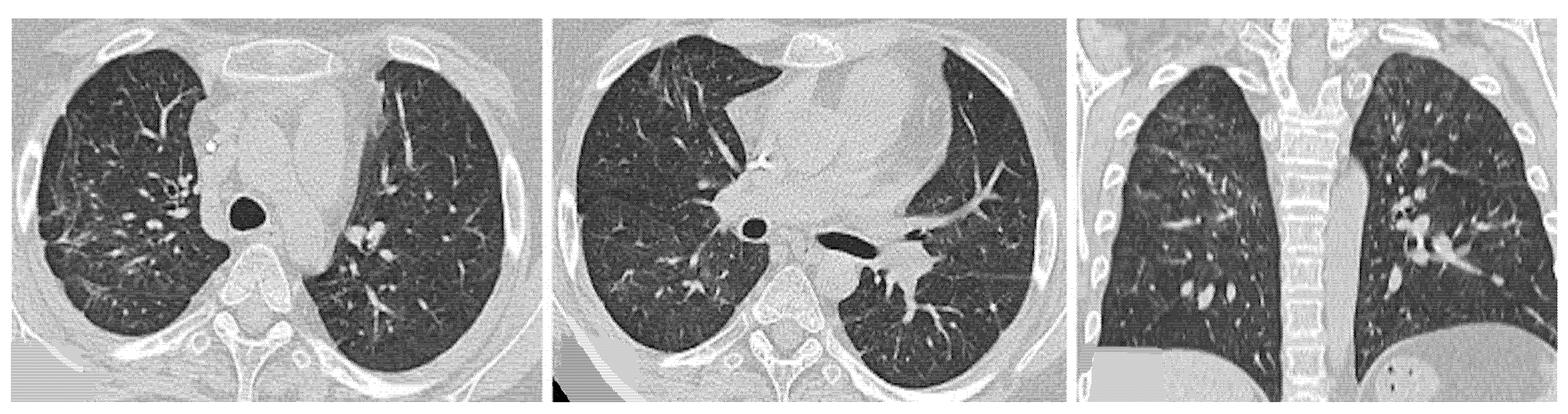 Medicina 58 01757 g014