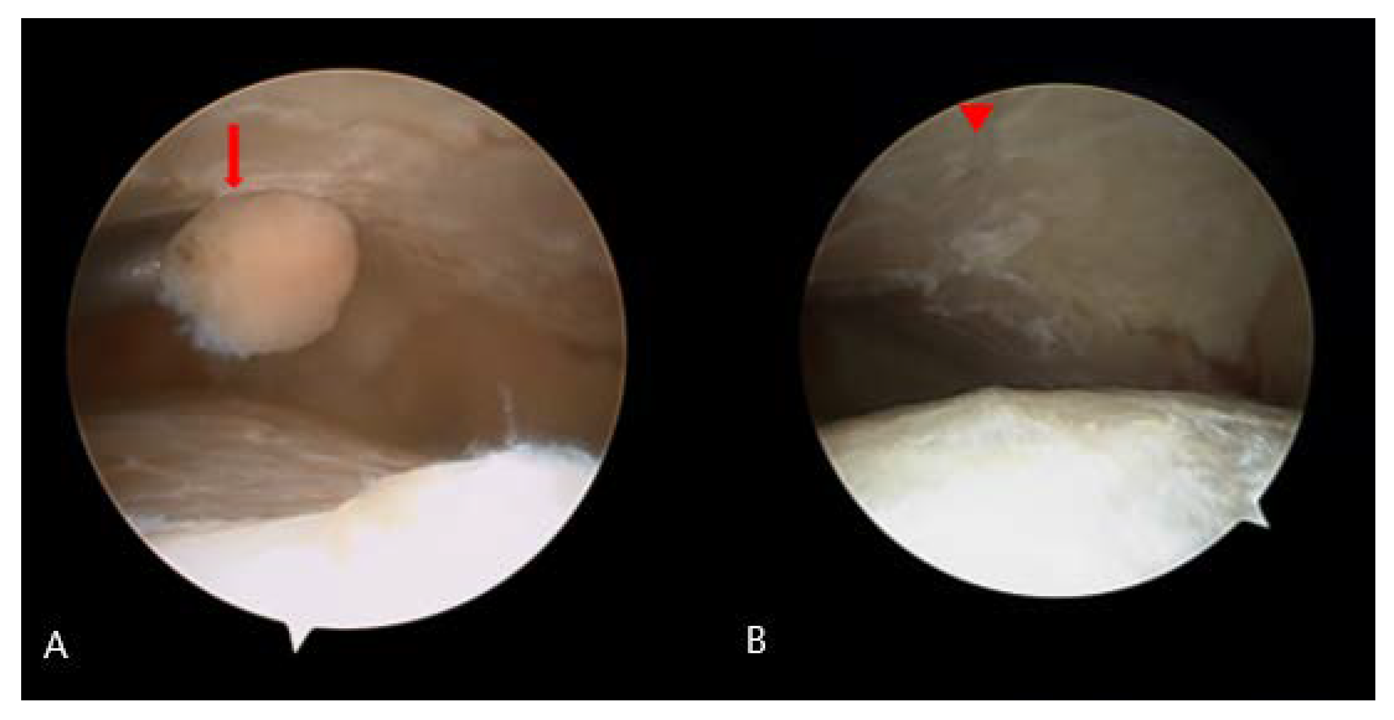 Medicina 58 01776 g005
