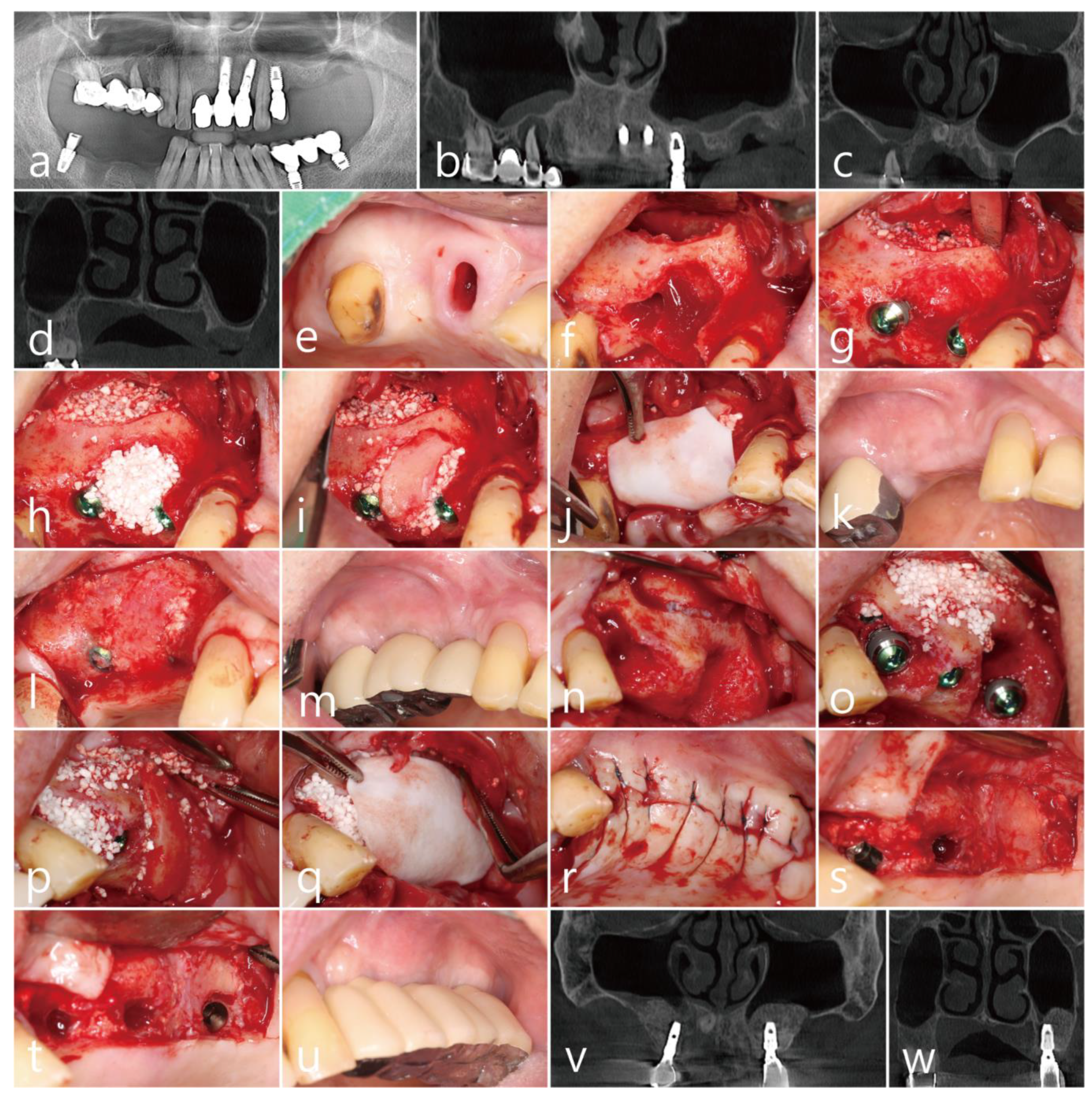 Medicina 58 01785 g003