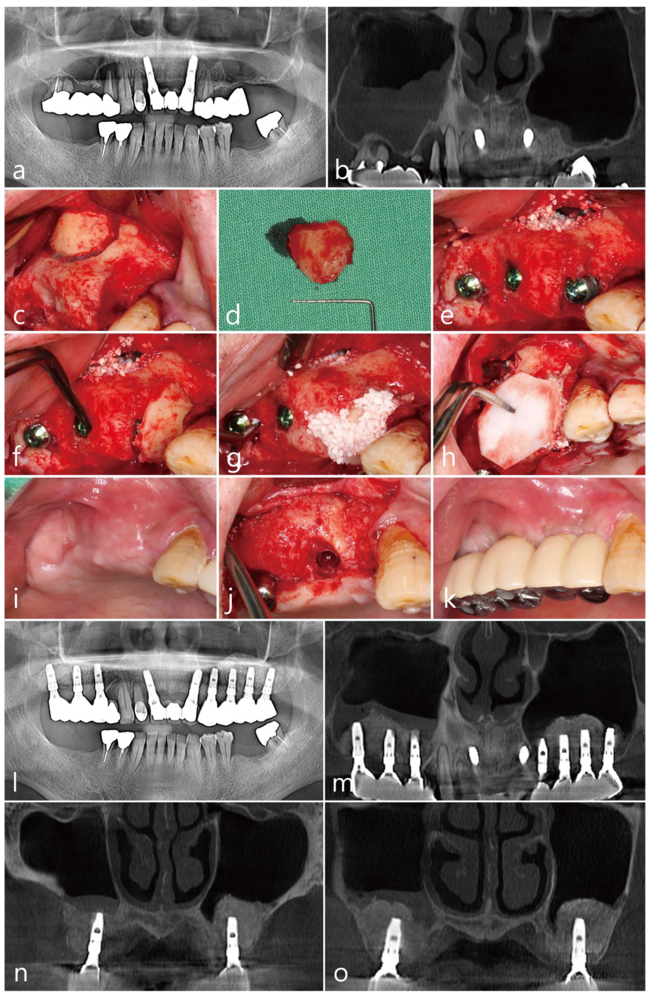 Medicina 58 01785 g004
