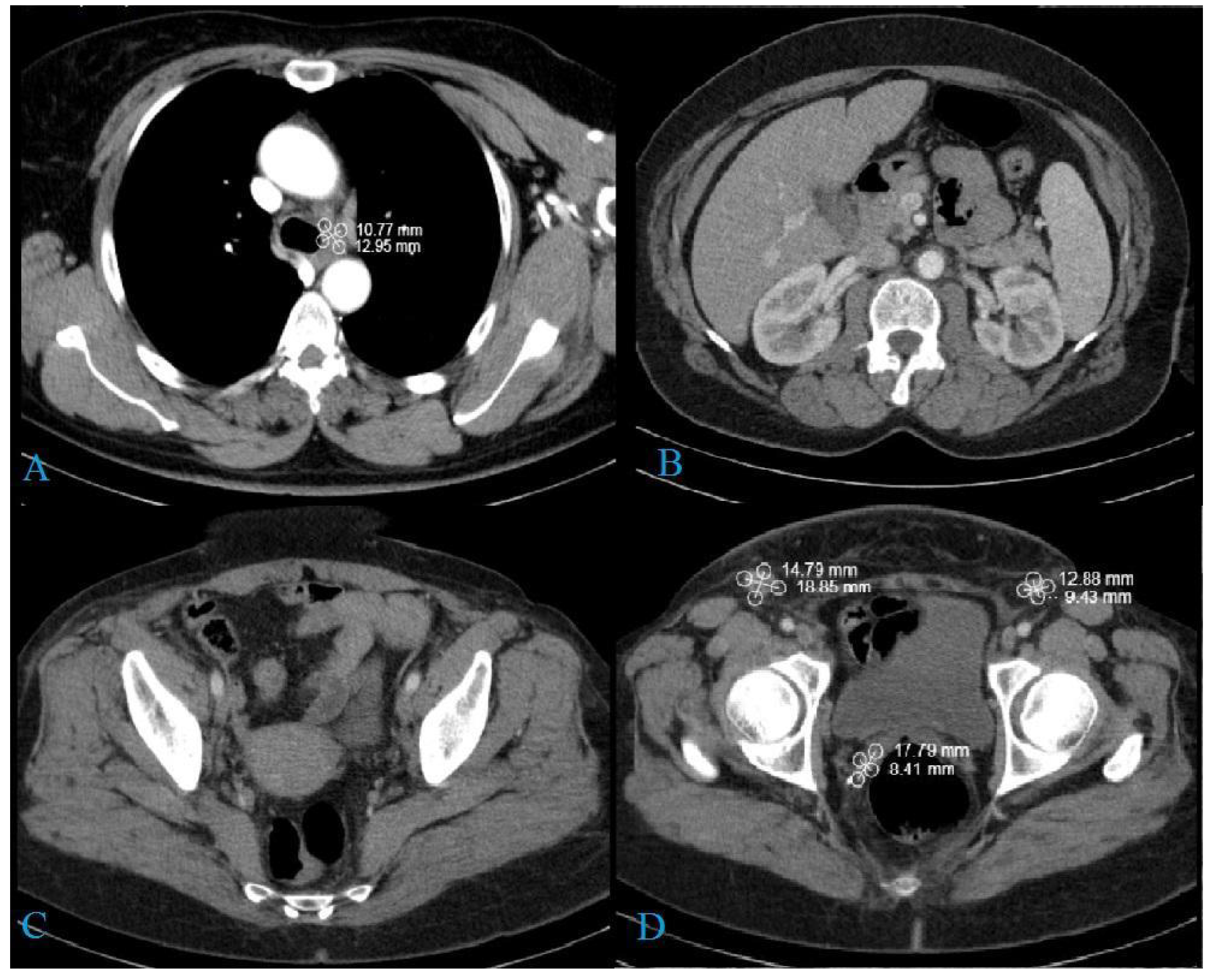 Medicina 58 01838 g005