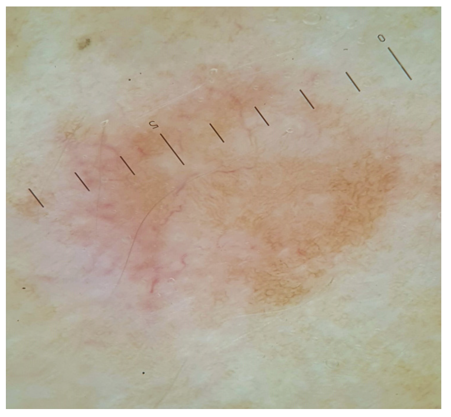 Medicina 58 01845 g002