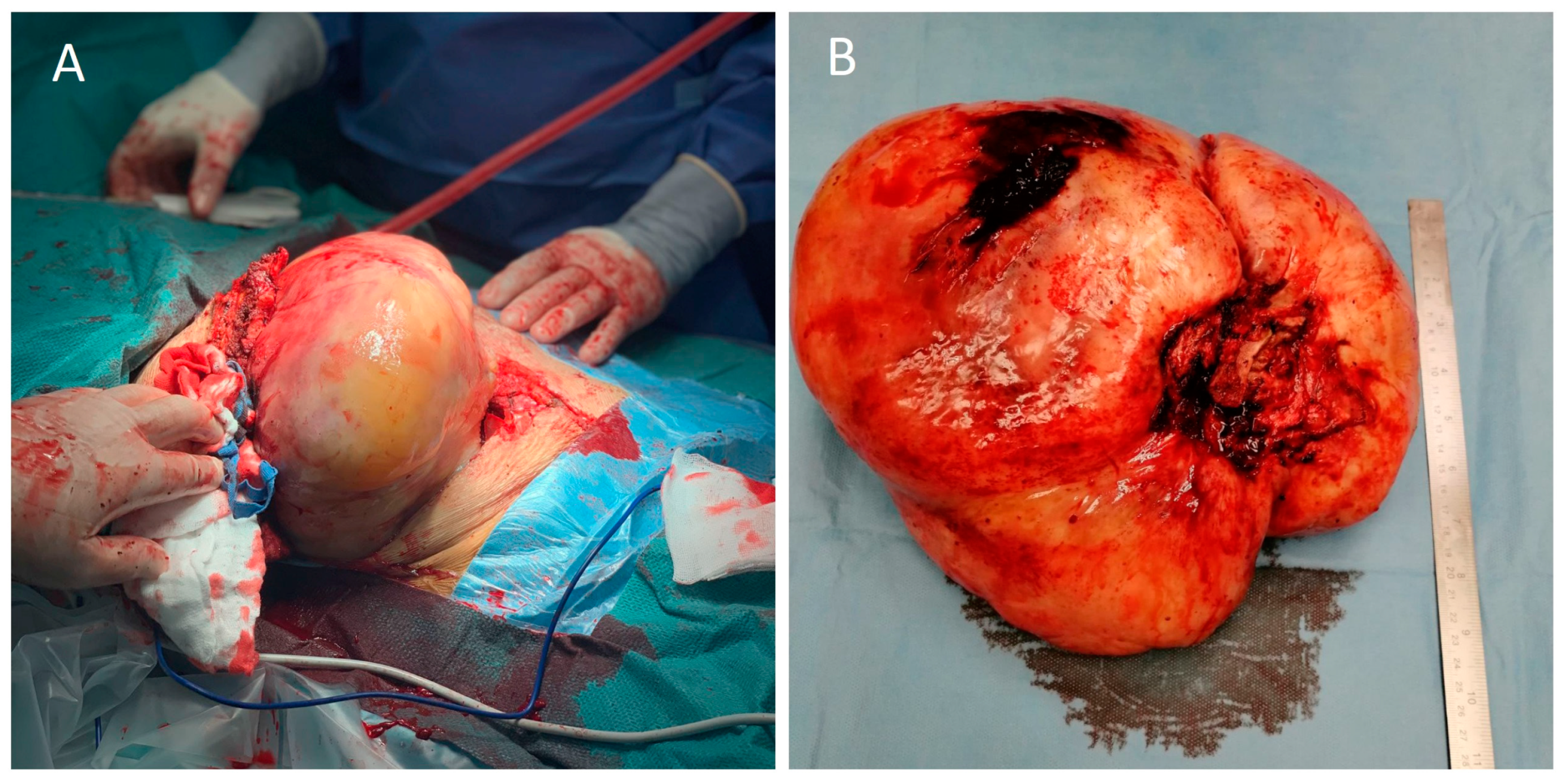 Medicina 58 01857 g002