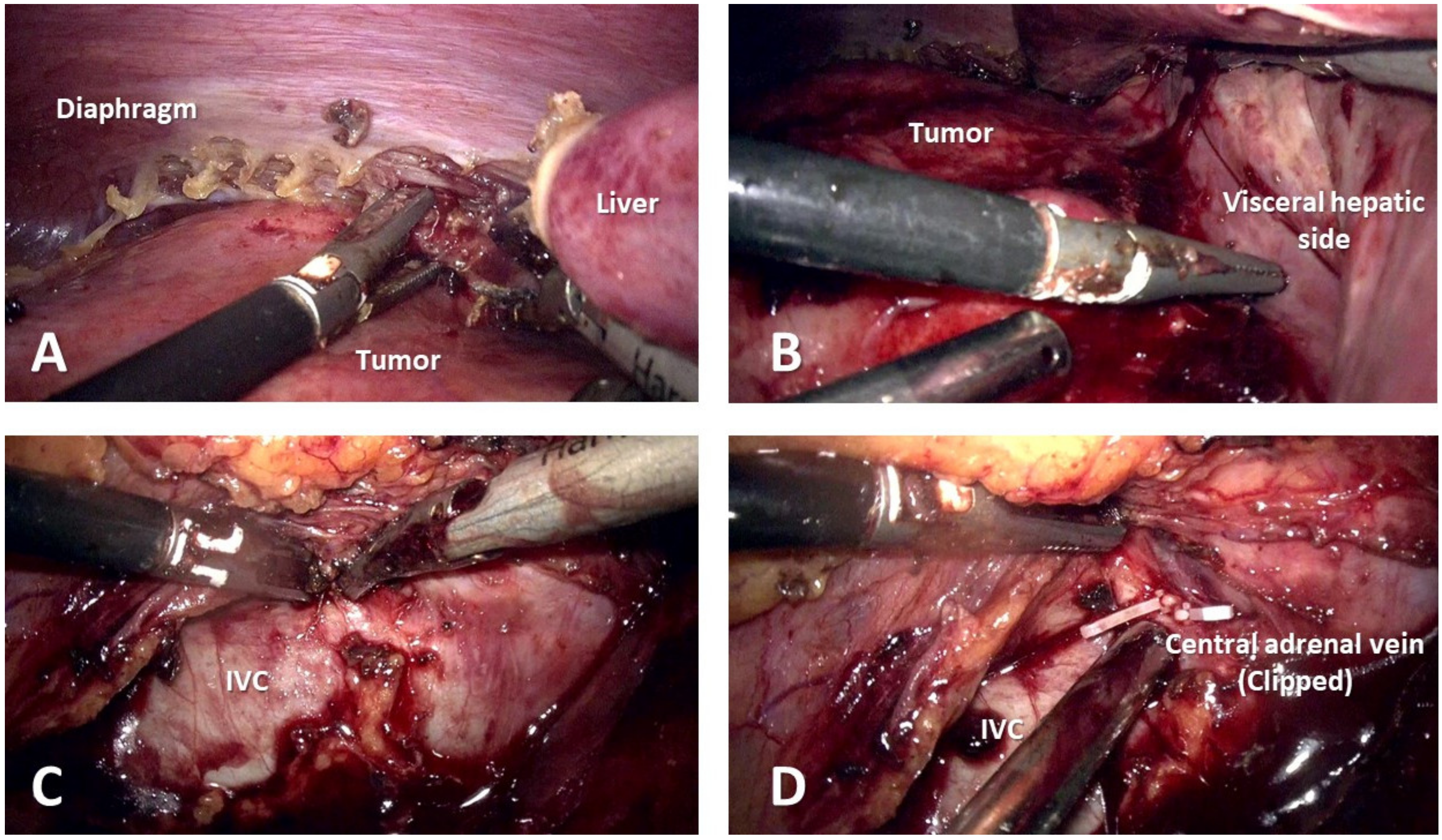 Medicina 59 00033 g003 Medicina 59 00033 g003