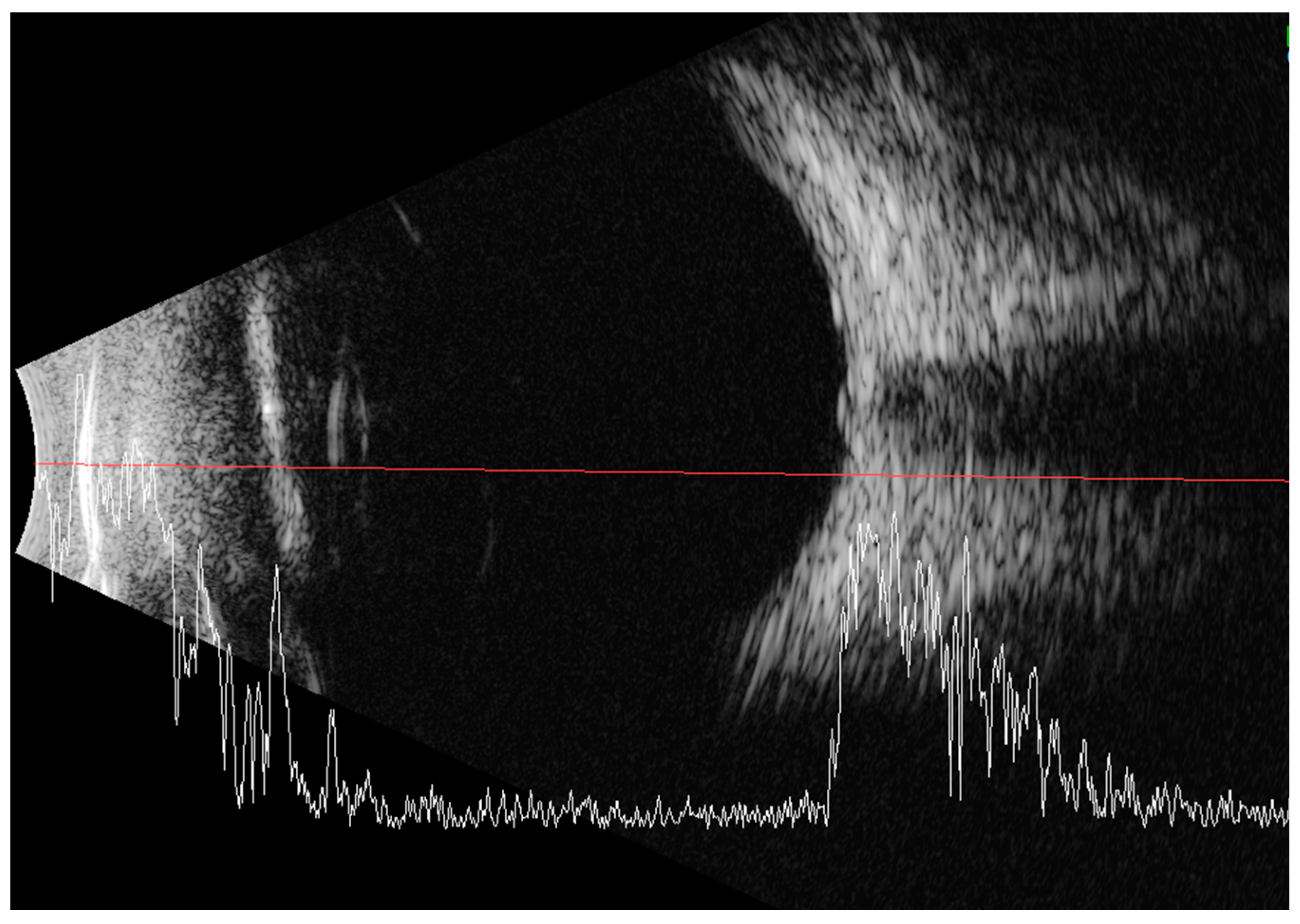 Medicina 59 00101 g003 Medicina 59 00101 g003