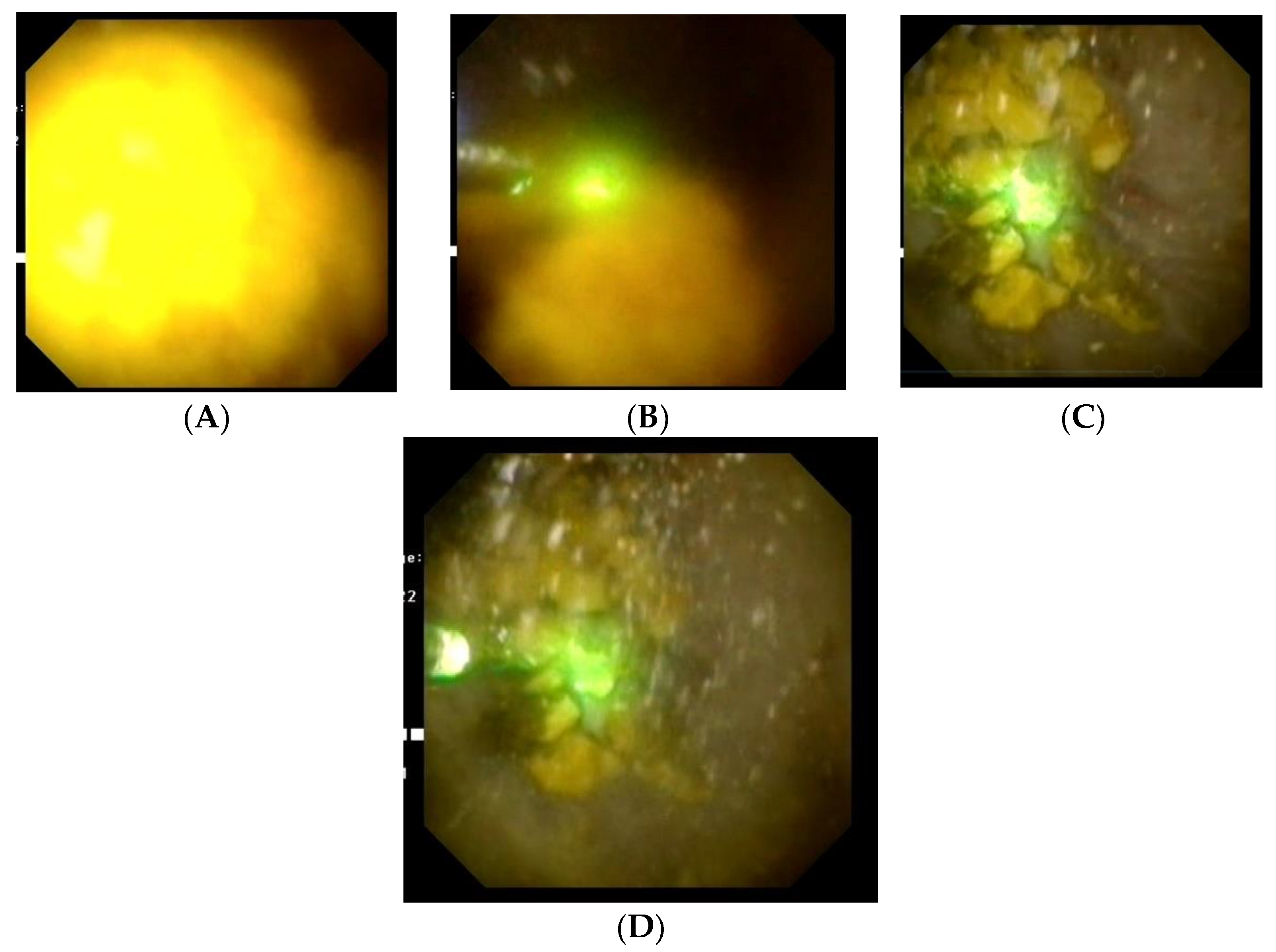 Medicina 59 00124 g002