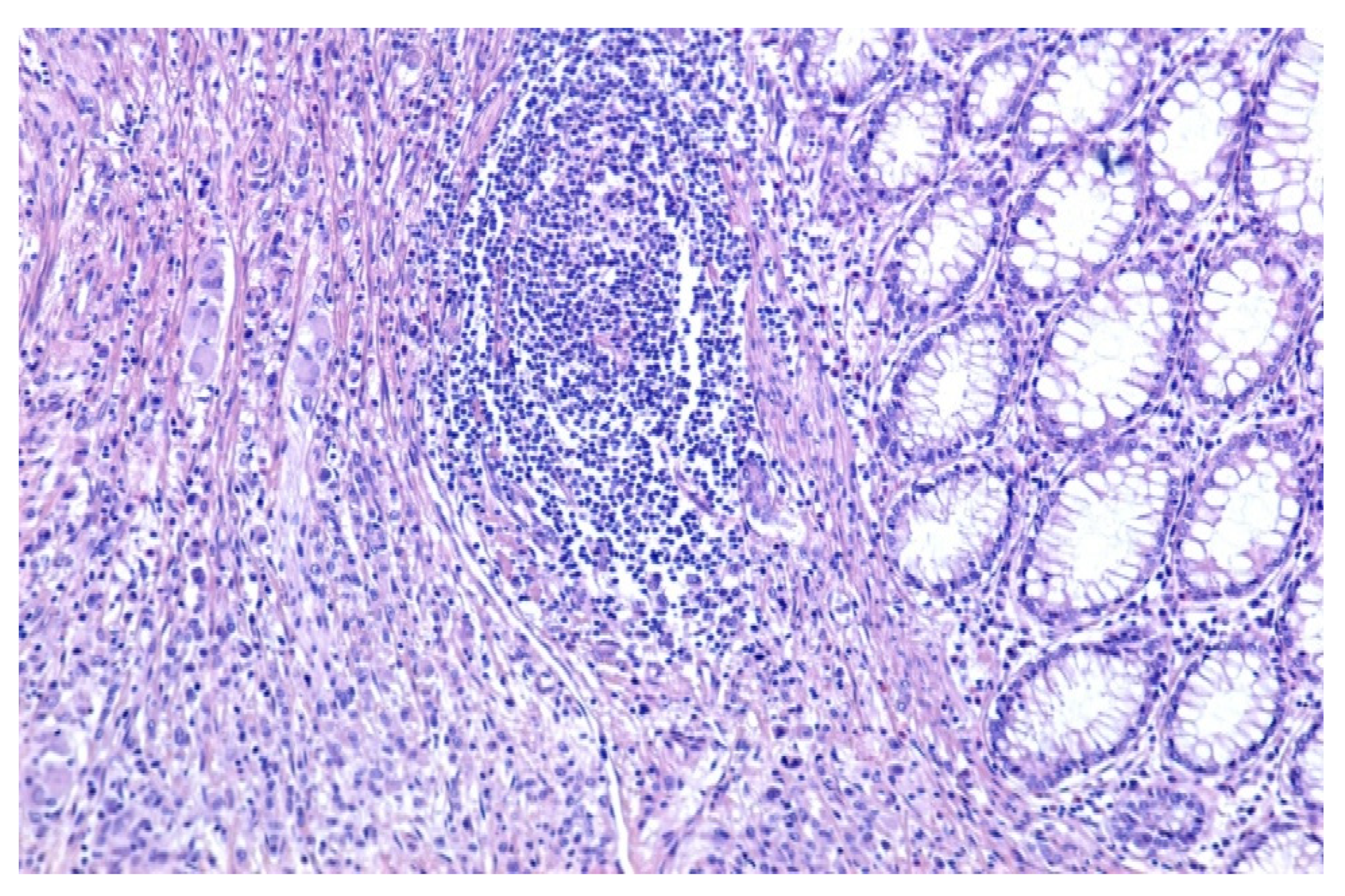 Medicina 59 00156 g002