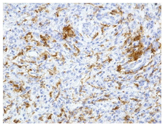 Medicina 59 00156 g005