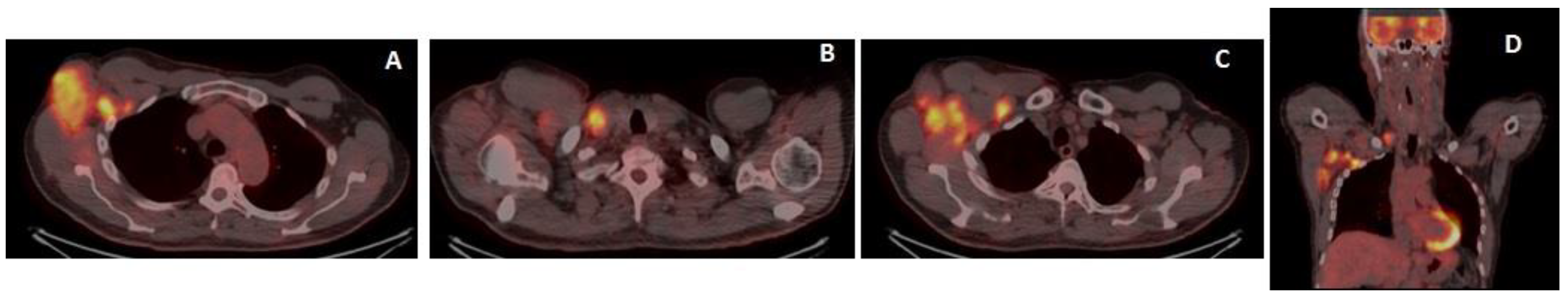 Medicina 59 00157 g005